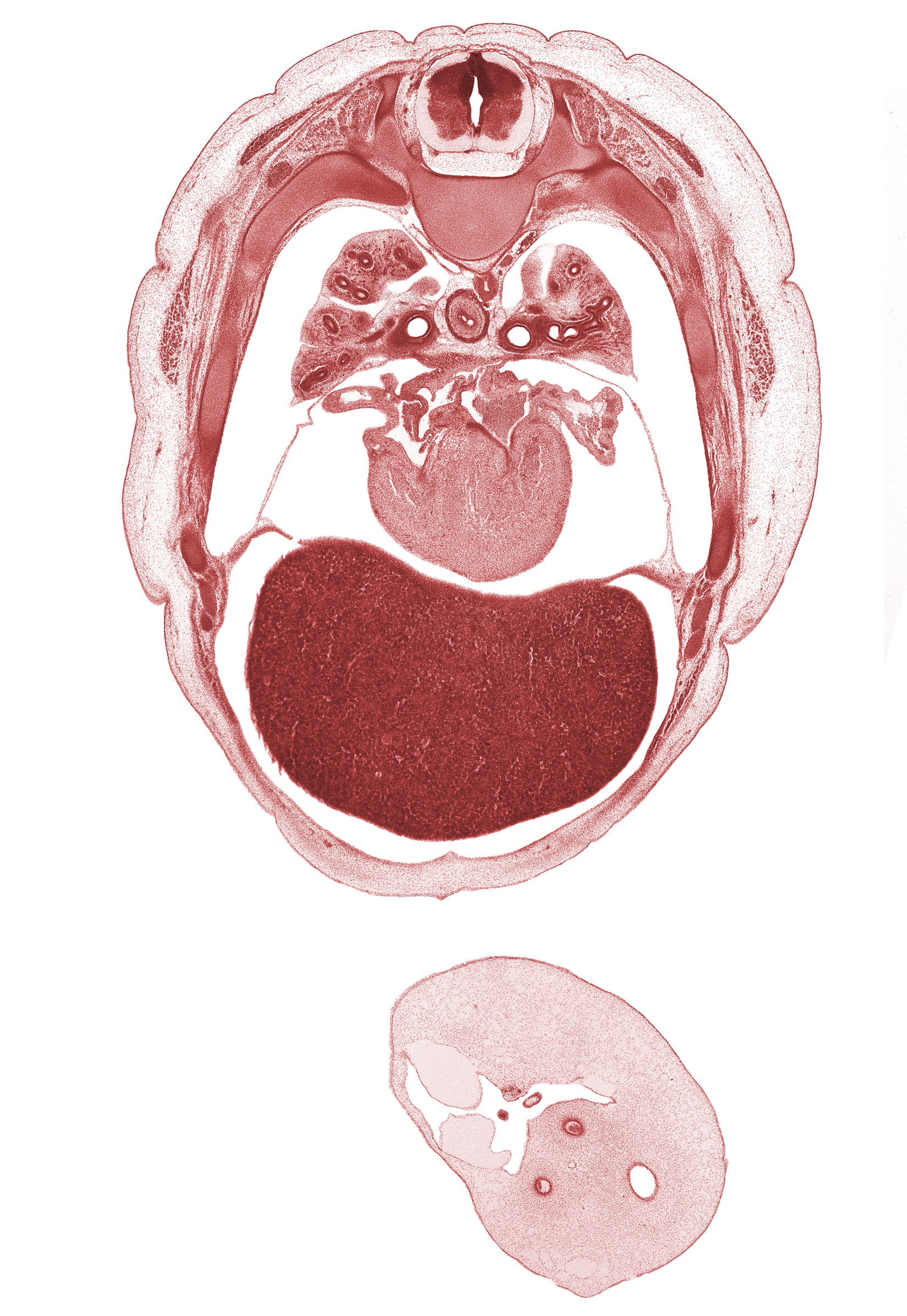 T-4 / T-5 interganglion region, allantois, azygos vein, latissimus dorsi muscle, left lobe of liver, left umbilical artery, left ventricle, lower secondary bronchus, primary interatrial septum (septum primum), rib 5, right atrium, right lobe of liver, right umbilical artery, right ventricle, serratus anterior muscle, sinus venosus, trapezius muscle, umbilical vein, upper lobe of left lung