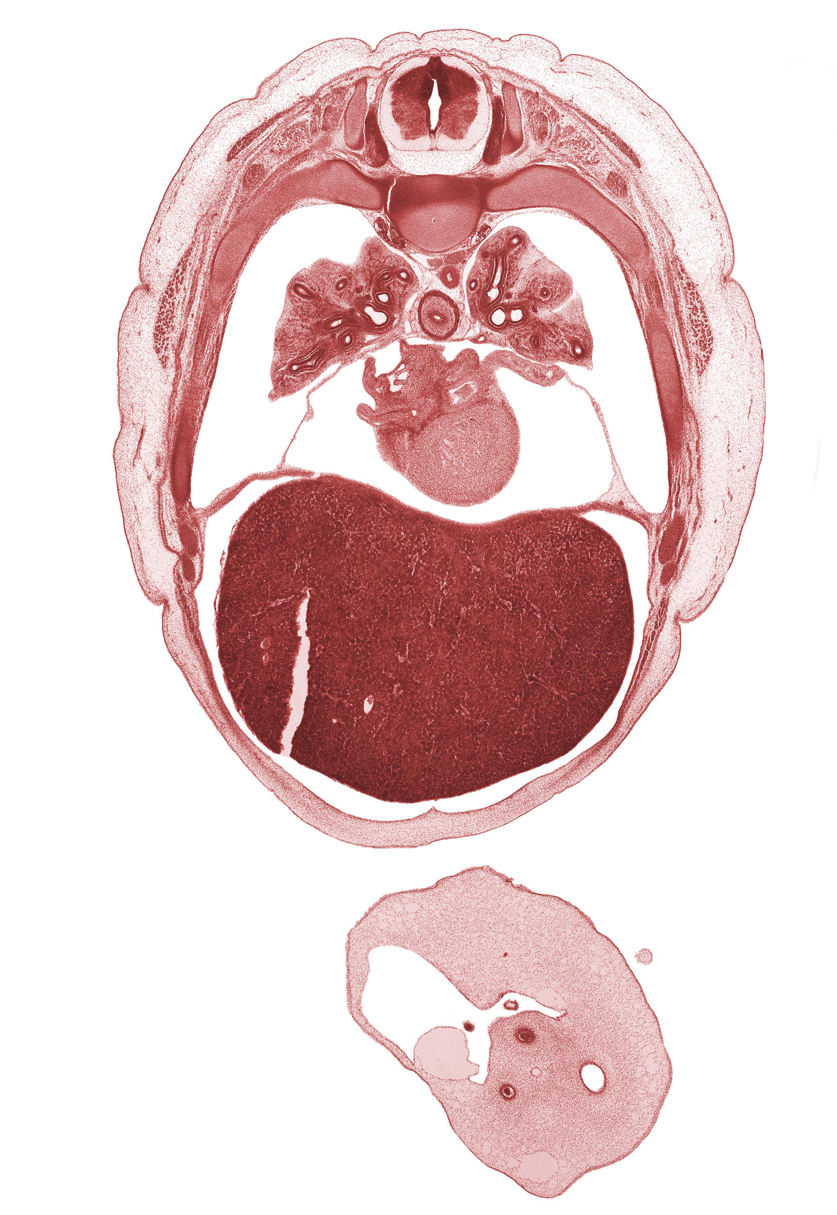 T-5 spinal ganglion, allantois, amnion on surface of umbilical cord, aorta, apex of heart, artifact separation(s), esophagus, latissimus dorsi muscle, left atrium, left lobe of liver, left lower pulmonary vein, left umbilical artery, left ventricle, lower secondary bronchus, oblique pericardial sinus, rib 6, rib 7, rib 8, rib 9, right lobe of liver, right umbilical artery, trapezius muscle, umbilical vein