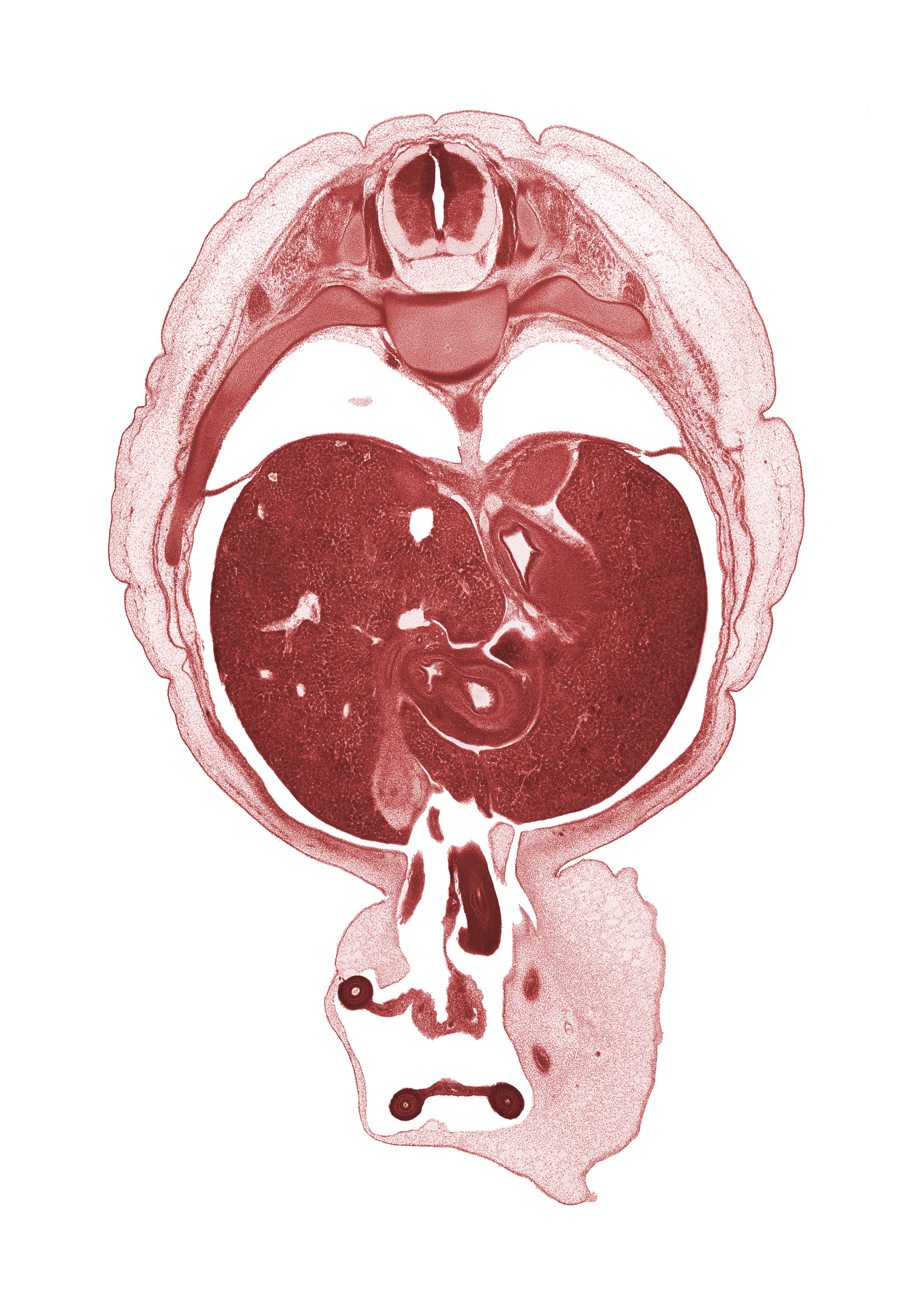 T-9 spinal ganglion, alar plate(s), allantois, aorta, basal plate, common hepatic duct, cystic duct, distal limb of herniated midgut, edge of umbilical vesicle stalk, epiploic foramen, first part of duodenum, floor plate, fundus of stomach, inferior vena cava, left lobe of liver, left umbilical artery, proximal limb of herniated midgut, pyloric antrum of stomach, pyloric sphincter, quadrate lobe of liver, rib 10, right umbilical artery, roof plate, sulcus limitans