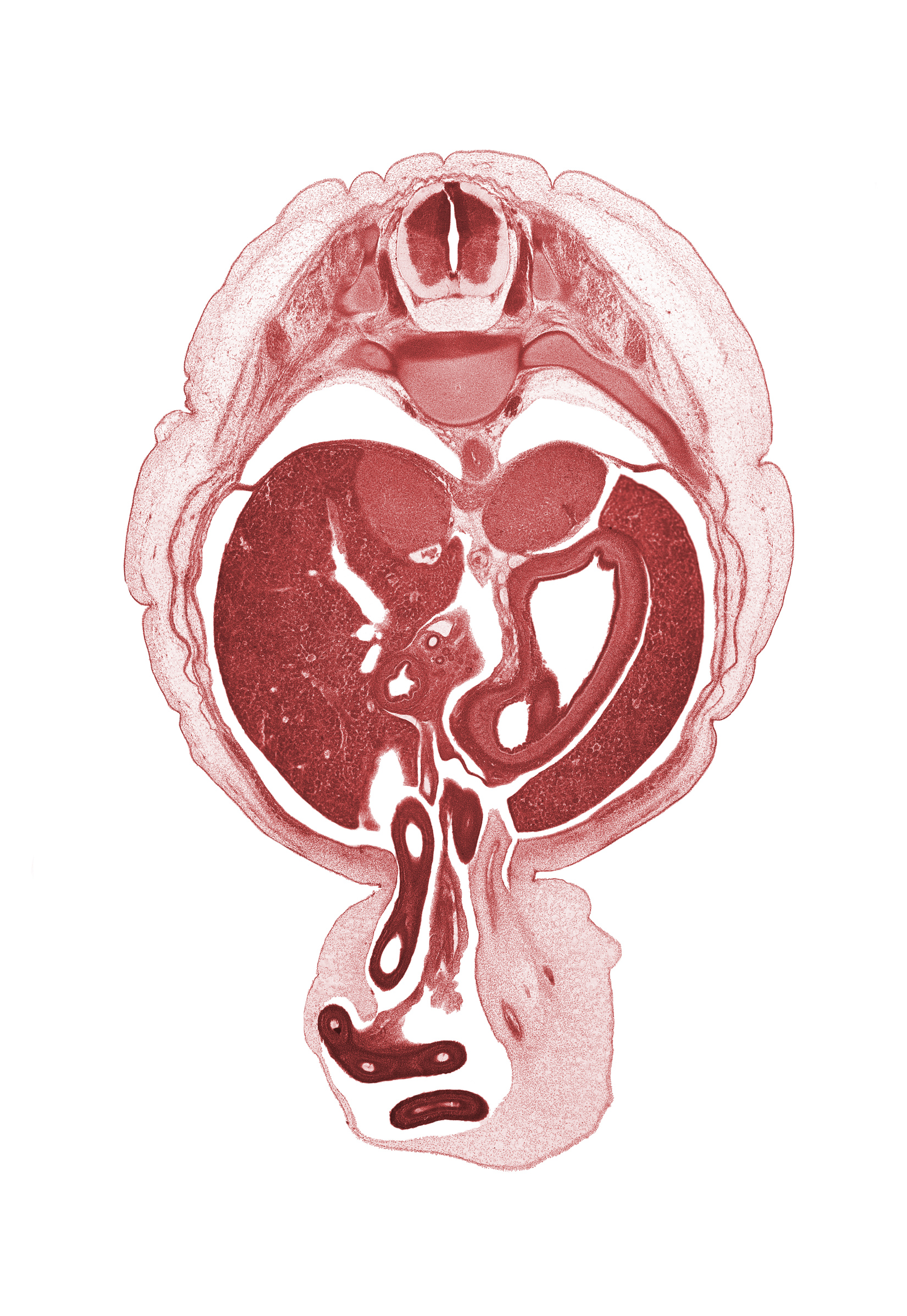 T-10 / T-11 intervertebral disc, T-10 spinal ganglion, allantois, aorta, bile duct, body of stomach, central canal, distal limb of midgut, duodenum, fundus of stomach, head of ventral pancreas, hepatic artery, hepatic portal vein, left lobe of liver, left umbilical artery, midpoint of herniated midgut loop, proximal limb of herniated midgut, rib 11, right lobe of liver, right umbilical artery, suprarenal gland cortex, umbilical vesicle stalk