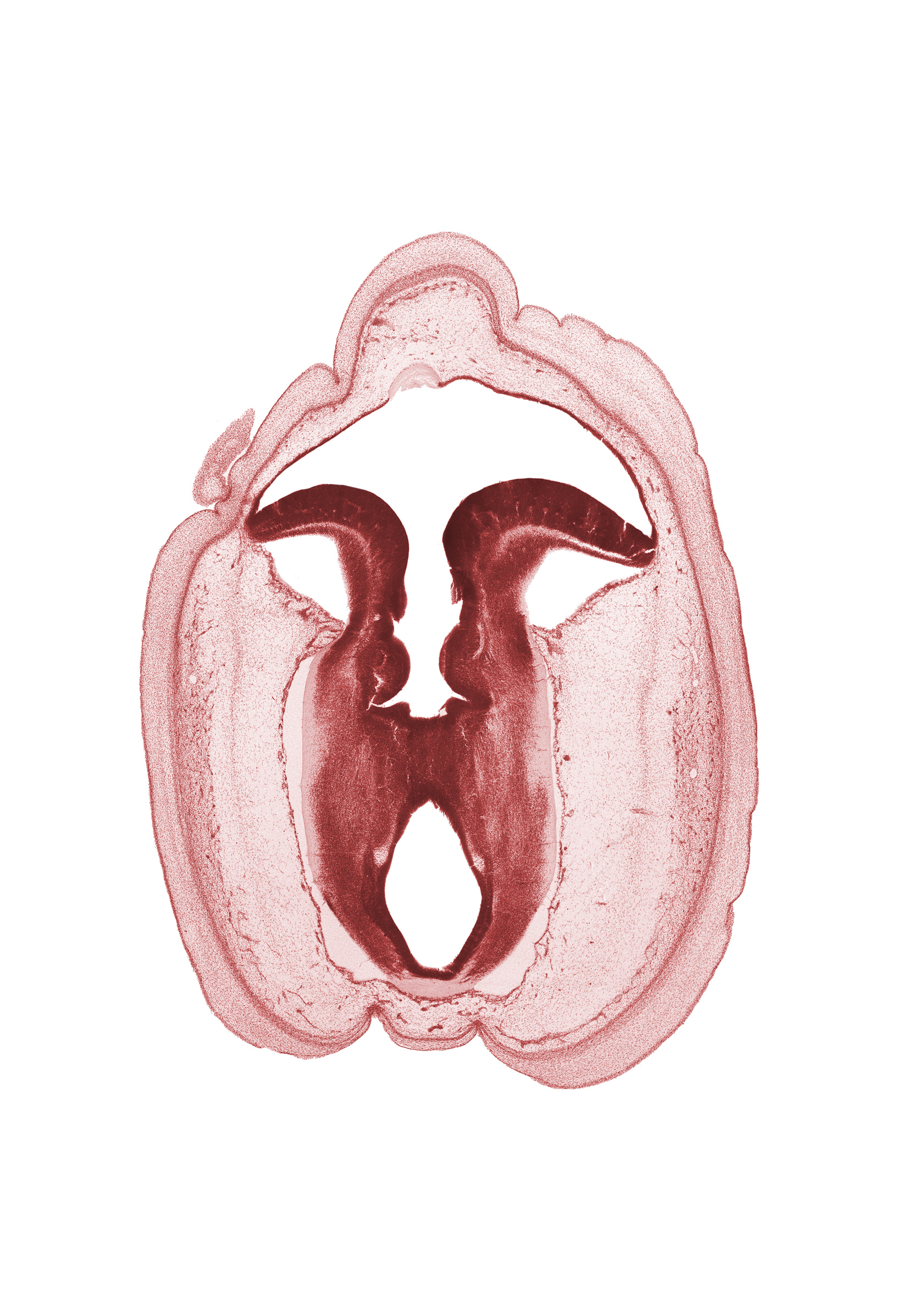artifact space(s), cerebral aqueduct (mesocoele), commissure in roof plate of mesencephalon, fiber tract, floor plate of mesencephalon, head mesenchyme, osteogenic layer, rhombencoel (fourth ventricle), roof plate of metencephalon, subarachnoid space, sulcus limitans, surface ectoderm, vascular plexus