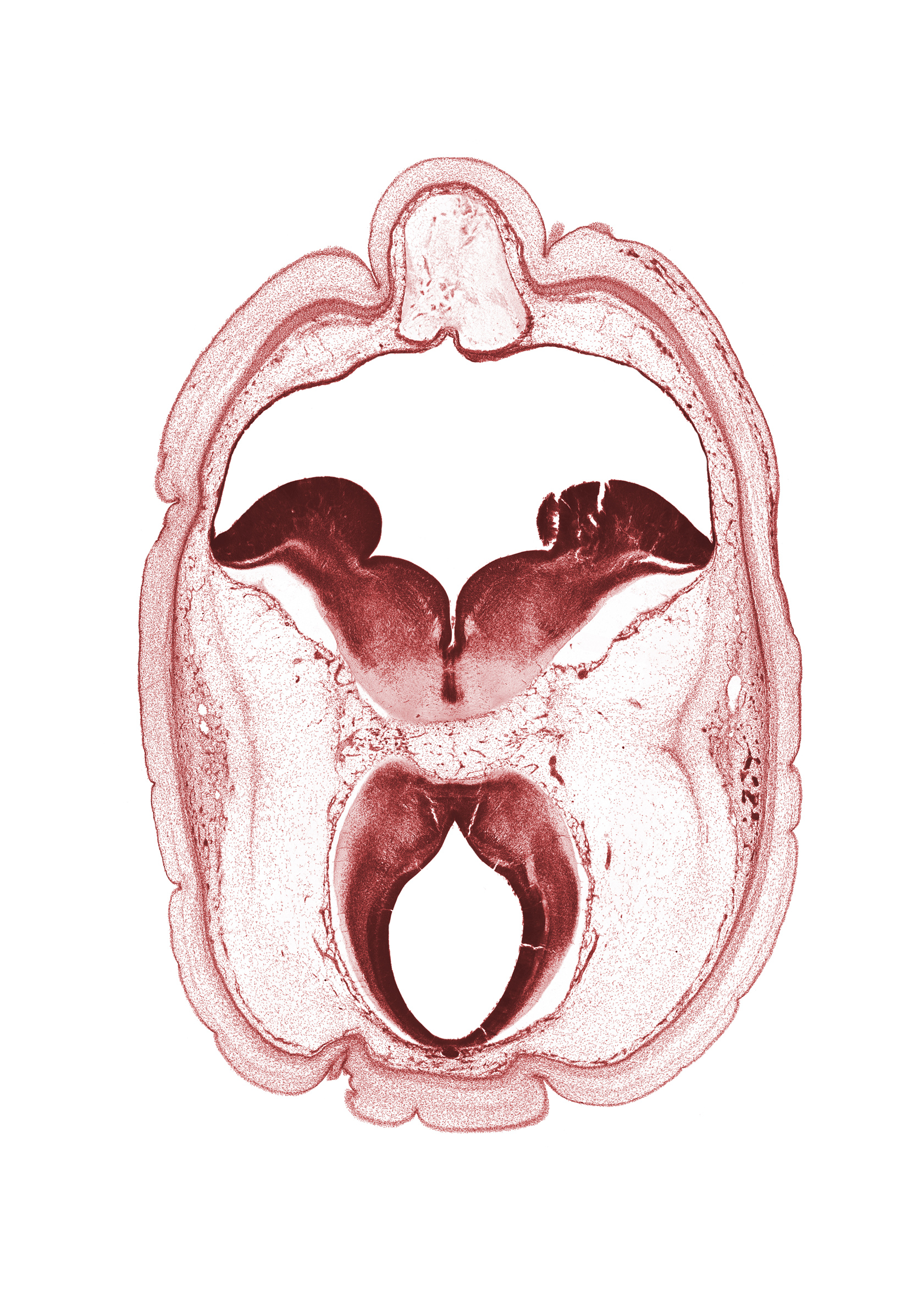 artifact fracture(s), artifact space(s), cephalic part of dural band for tentorium cerebelli, cerebral aqueduct (mesocoele), osteogenic layer, pons region (metencephalon), region of mesencephalic (cephalic) flexure, rhombencoel (fourth ventricle), root of oculomotor nerve (CN III), subarachnoid space, superficial vascular plexus