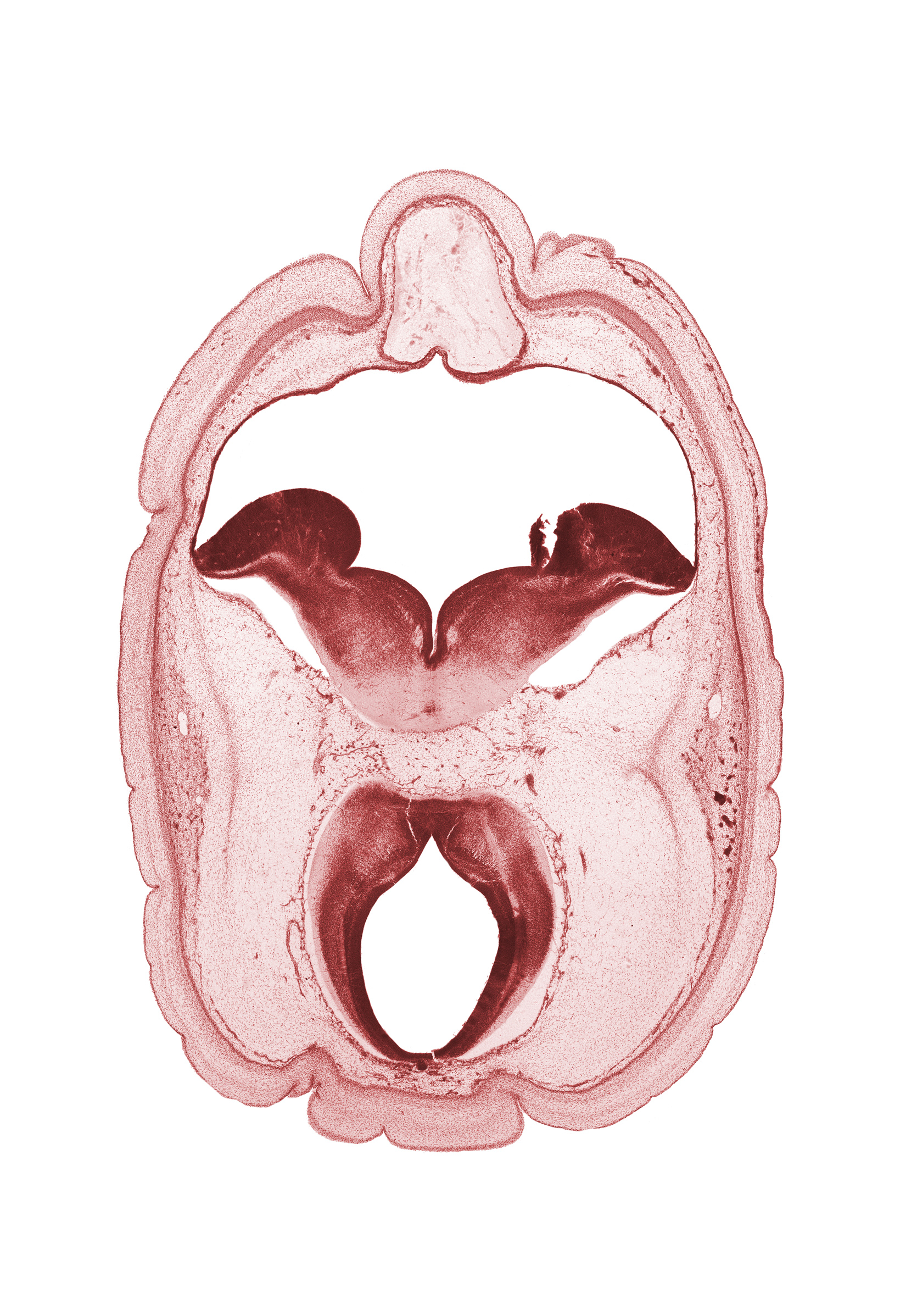 alar plate(s), artifact fracture(s), artifact space(s), basal plate, diverticulum of rhombencoel (fourth ventricle), intermediate zone, marginal zone, mesencephalon, metencephalon, middle dural venous plexus, oculomotor nerve (CN III), pons region (metencephalon), posterior cerebral artery, rhombencoel (fourth ventricle), roof plate, ventricular zone