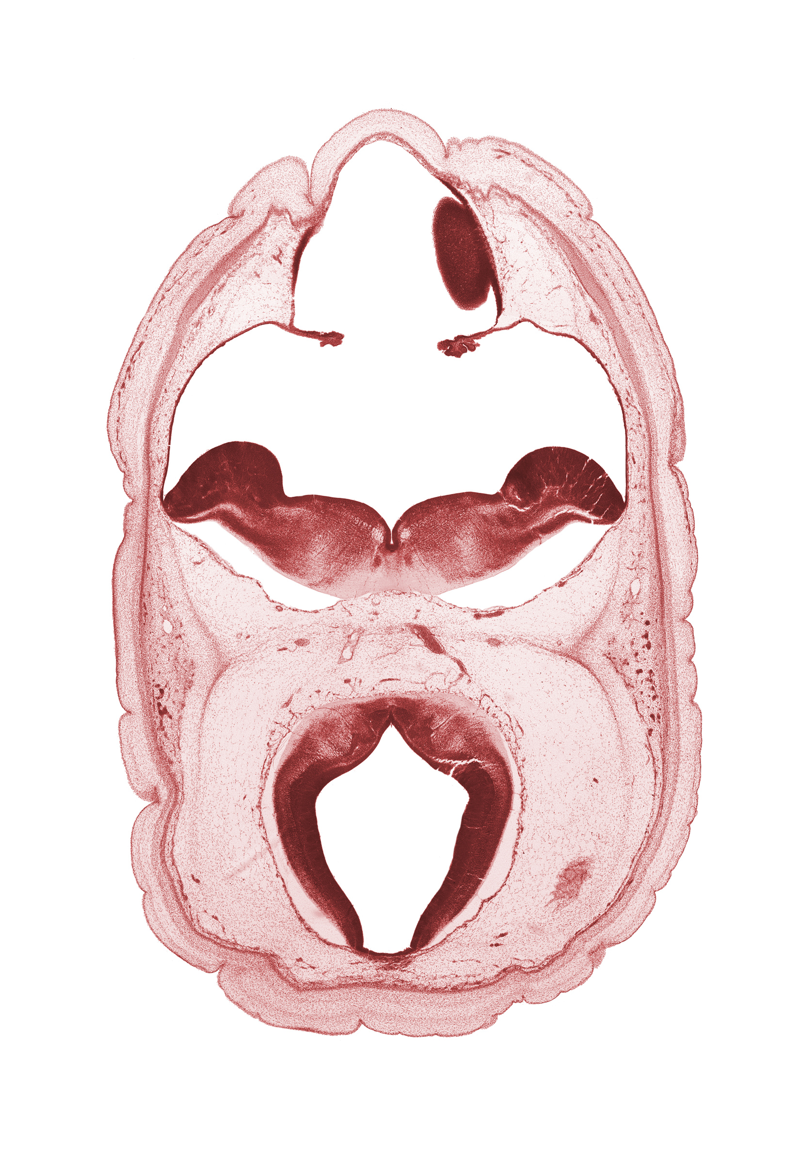 alar plate of metencephalon (cerebellum), artifact space(s), choroid plexus, diverticulum of rhombencoel (fourth ventricle), edge of cerebral vesicle (hemisphere), metencephalon, myelencephalon, oculomotor nerve (CN III), rhombencoel (fourth ventricle), roof plate, subarachnoid space, tectum of mesencephalon, trochlear nerve (CN IV), vascular plexus