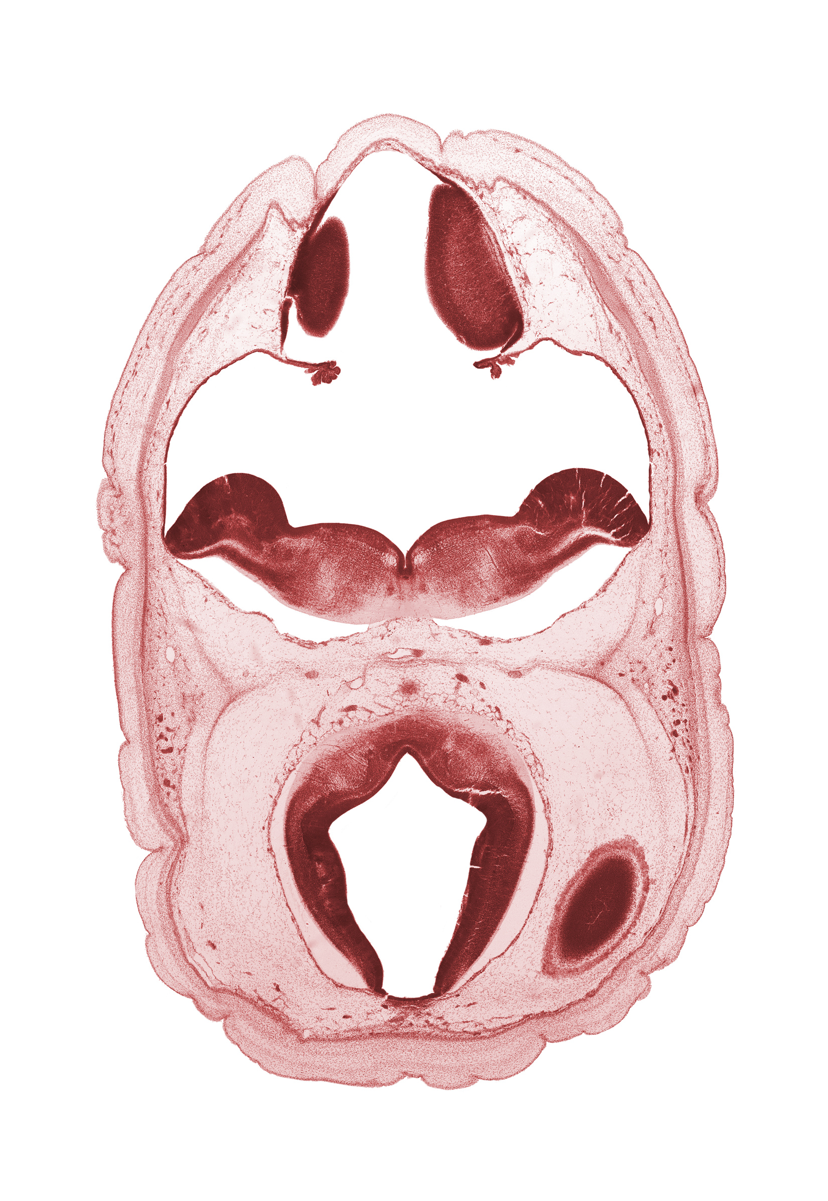alar plate of myelencephalon, artifact space(s), cephalic end of basilar artery, cerebral aqueduct (mesocoele), cerebral vesicle (hemisphere), choroid plexus, dural band for tentorium cerebelli, oculomotor nerve (CN III), osteogenic layer, rhombencoel (fourth ventricle), roof plate of myelencephalon, subarachnoid space, sulcus limitans, trochlear nerve (CN IV)
