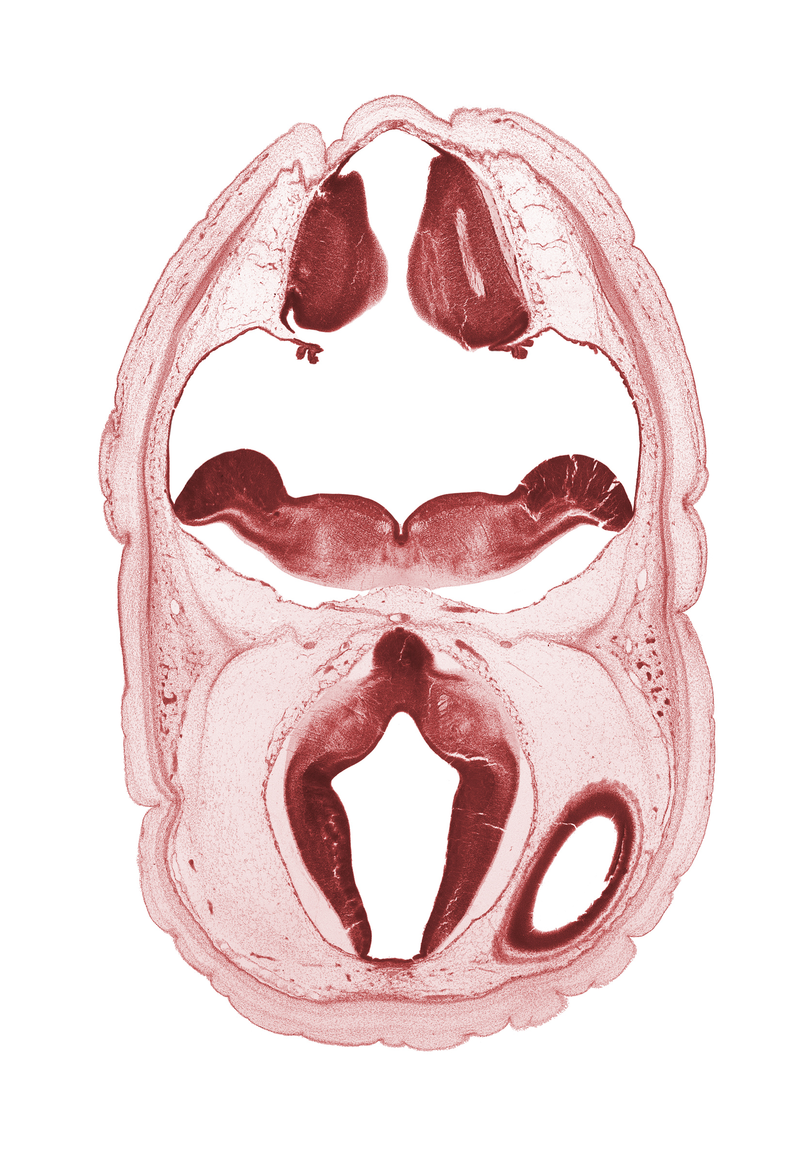 alar plate of myelencephalon, alar plate(s), artifact space(s), basilar artery, cerebral vesicle (hemisphere), choroid plexus, fiber tract, hypothalamic sulcus, hypothalamus, lateral ventricle, oculomotor nerve (CN III), osteogenic layer, posterior communicating artery, rhombencoel (fourth ventricle), roof plate, roof plate of diencephalon, roof plate of myelencephalon, trochlear nerve (CN IV), ventral thalamus