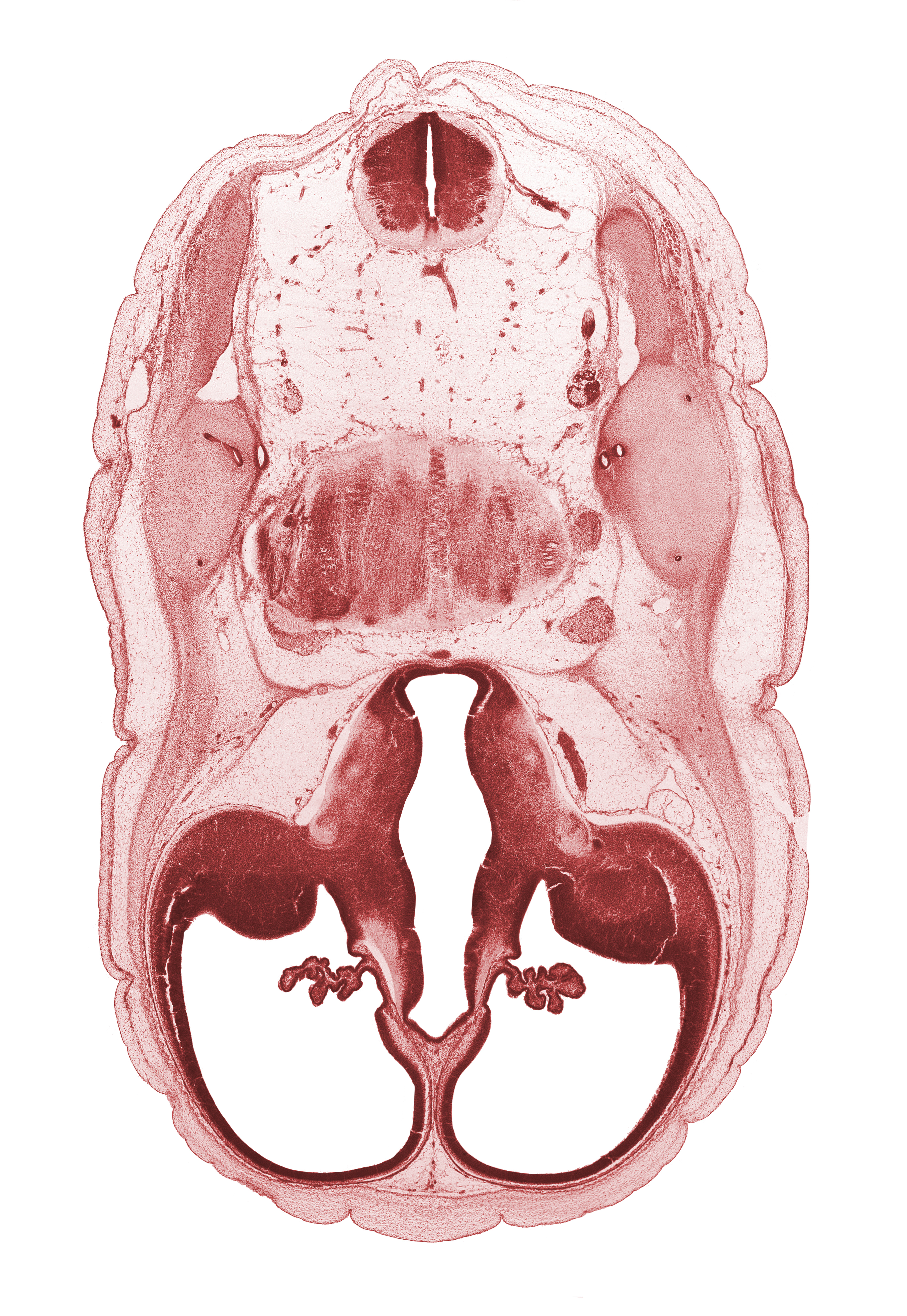accessory nerve (CN XI), anterior semicircular duct, central canal, choroid plexus, common crus, decussation, dorsal thalamus, endolymphatic duct, facial nerve (CN VII), fiber tract, hypothalamic sulcus, hypothalamus, lateral ventricular eminence (telencephalon), pons region (metencephalon), posterior semicircular duct, roof plate of diencephalon, root of trigeminal nerve (CN V), vagus nerve (CN X), ventral thalamus, vestibulocochlear nerve (CN VIII)