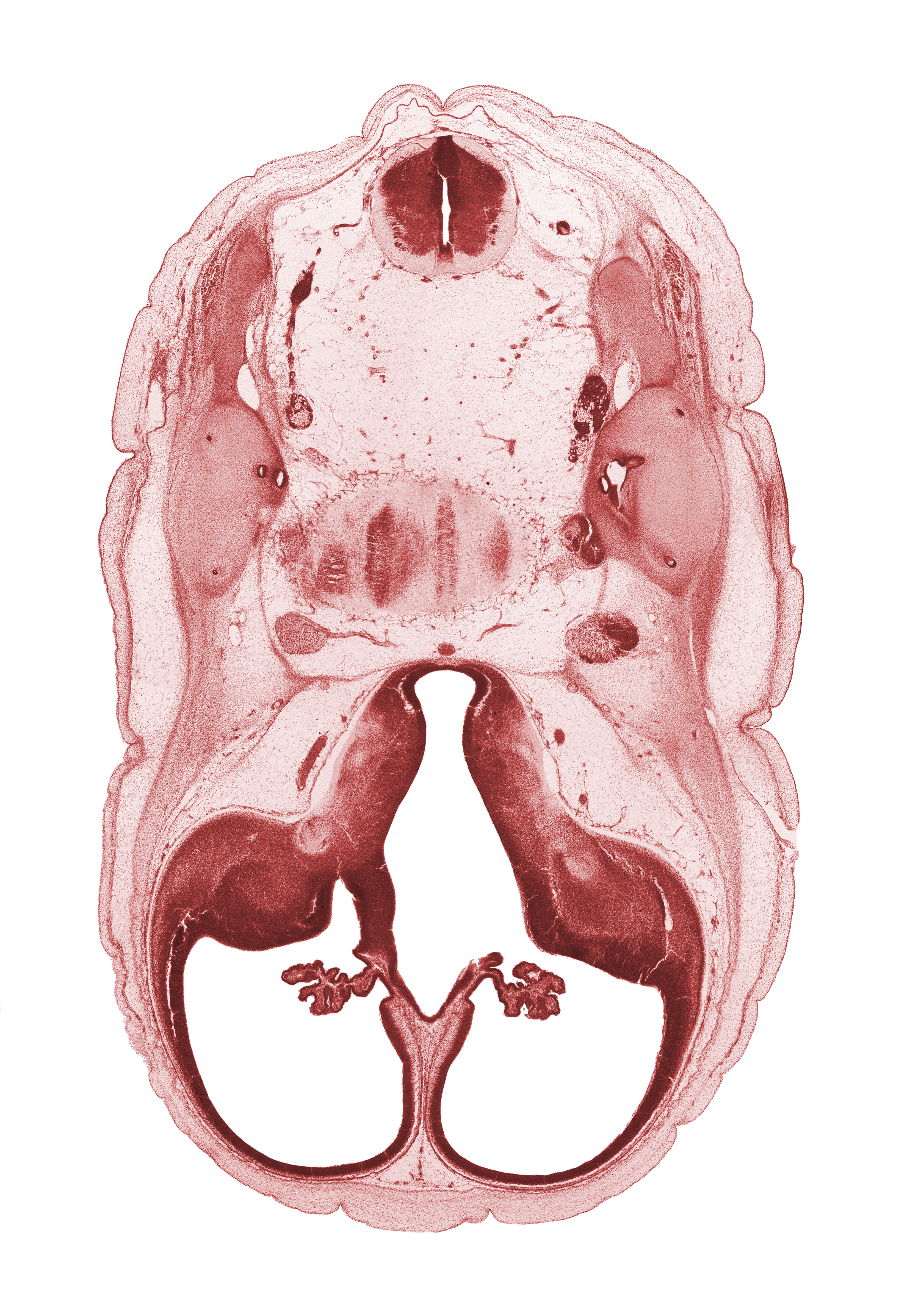 accessory nerve (CN XI), anterior semicircular duct, basilar artery, choroid plexus, decussation, endolymphatic duct, falx cerebri region, hypothalamus, interventricular foramen, lateral ventricle, posterior communicating artery, posterior semicircular duct, primordial cortical plate, sigmoid sinus, superior ganglion of vagus nerve (CN X), third ventricle, utricle, venous plexus(es)