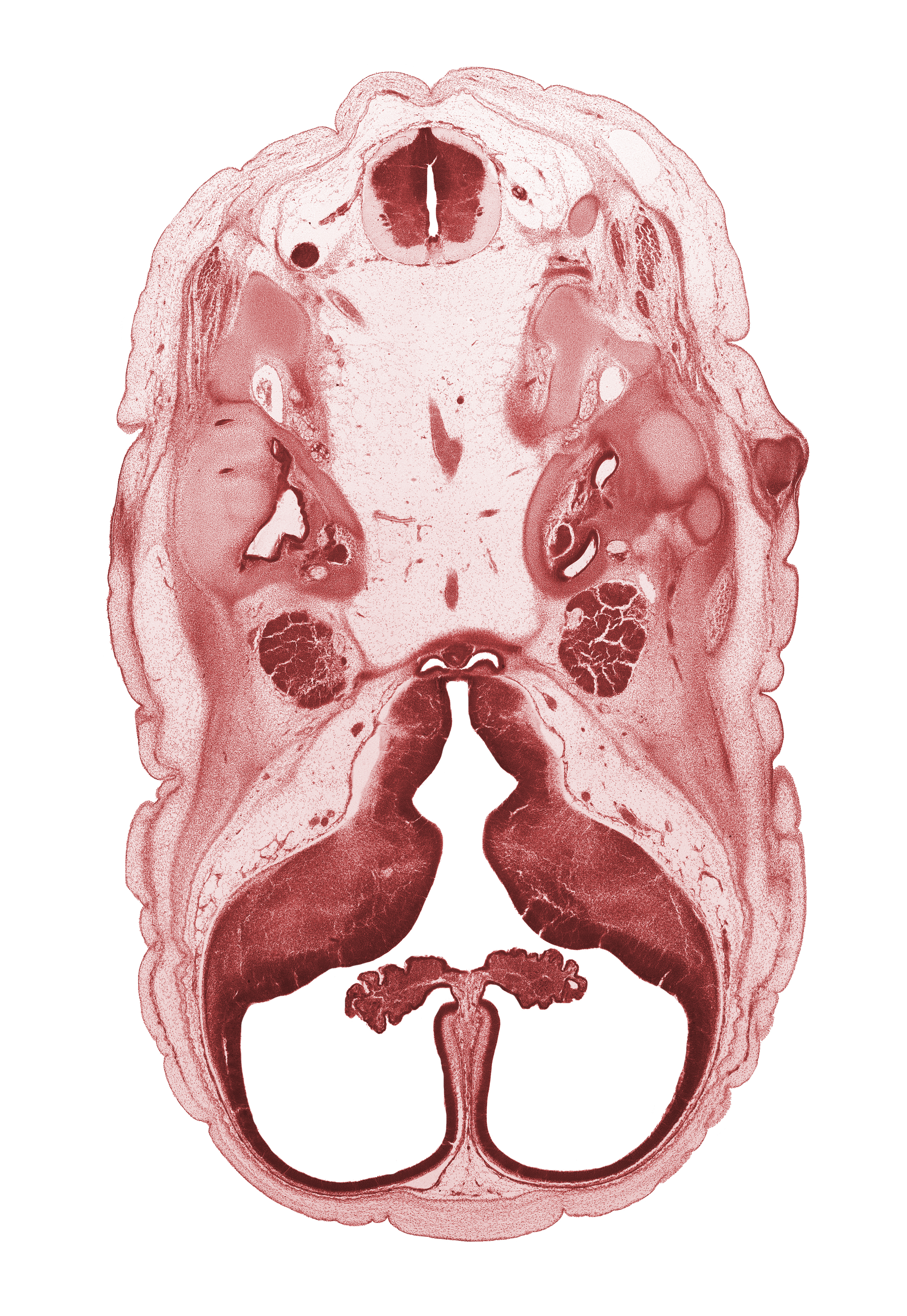 C-1 spinal nerve, abducens nerve (CN VI), basilar artery, central canal, cerebral vesicle (hemisphere), choroid plexus, cochlear duct, facial nerve (CN VII), falx cerebri region, head mesenchyme, hypoglossal nerve (CN XII), interventricular foramen, junction of basilar artery and vertebral arteries, lateral ventricle, lateral ventricular eminence (telencephalon), medial ventricular eminence (diencephalon), neurohypophysis, otic capsule cartilage, pharyngeal arch 1 cartilage (Meckel), posterior communicating artery, subarachnoid space, trigeminal ganglion (CN V), utricle, venous plexus(es), vertebral artery