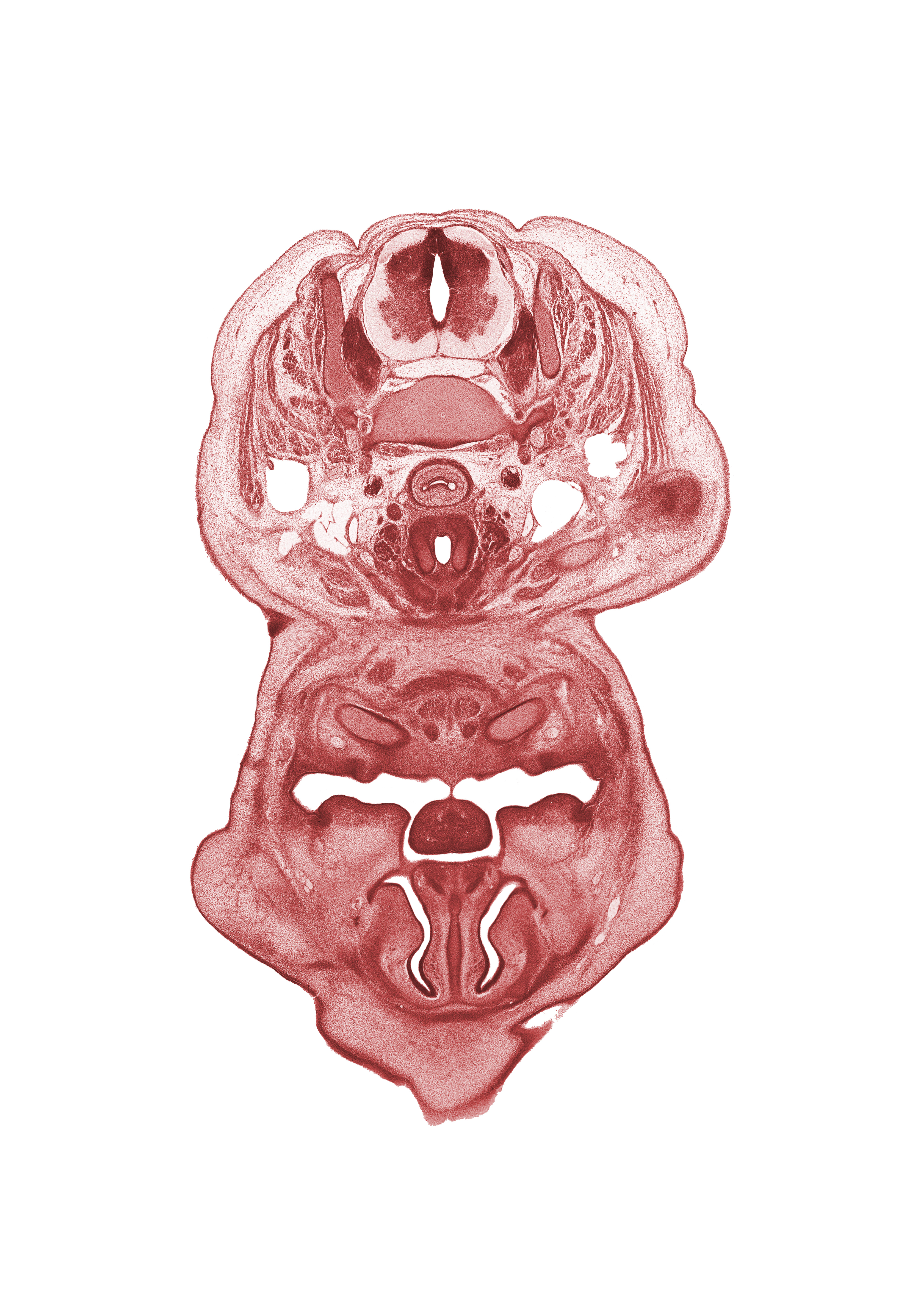 C-6 spinal ganglion, anterior belly of digastric muscle, central canal, cricoid cartilage, dorsal fasciculus, dorsum of tongue, esophagus endoderm, frenulum of tongue, inferior meatus, inferior nasal concha, internal carotid artery, internal jugular vein, jugular lymph sac, middle cervical sympathetic ganglion, mylohyoid muscle, nasal capsule cartilage condensation, nasal septal cartilage, nasolacrimal duct, neural arch, oral cavity, pharyngeal arch 1 cartilage (Meckel), superior parathyroid gland, thyroid gland, trapezius muscle