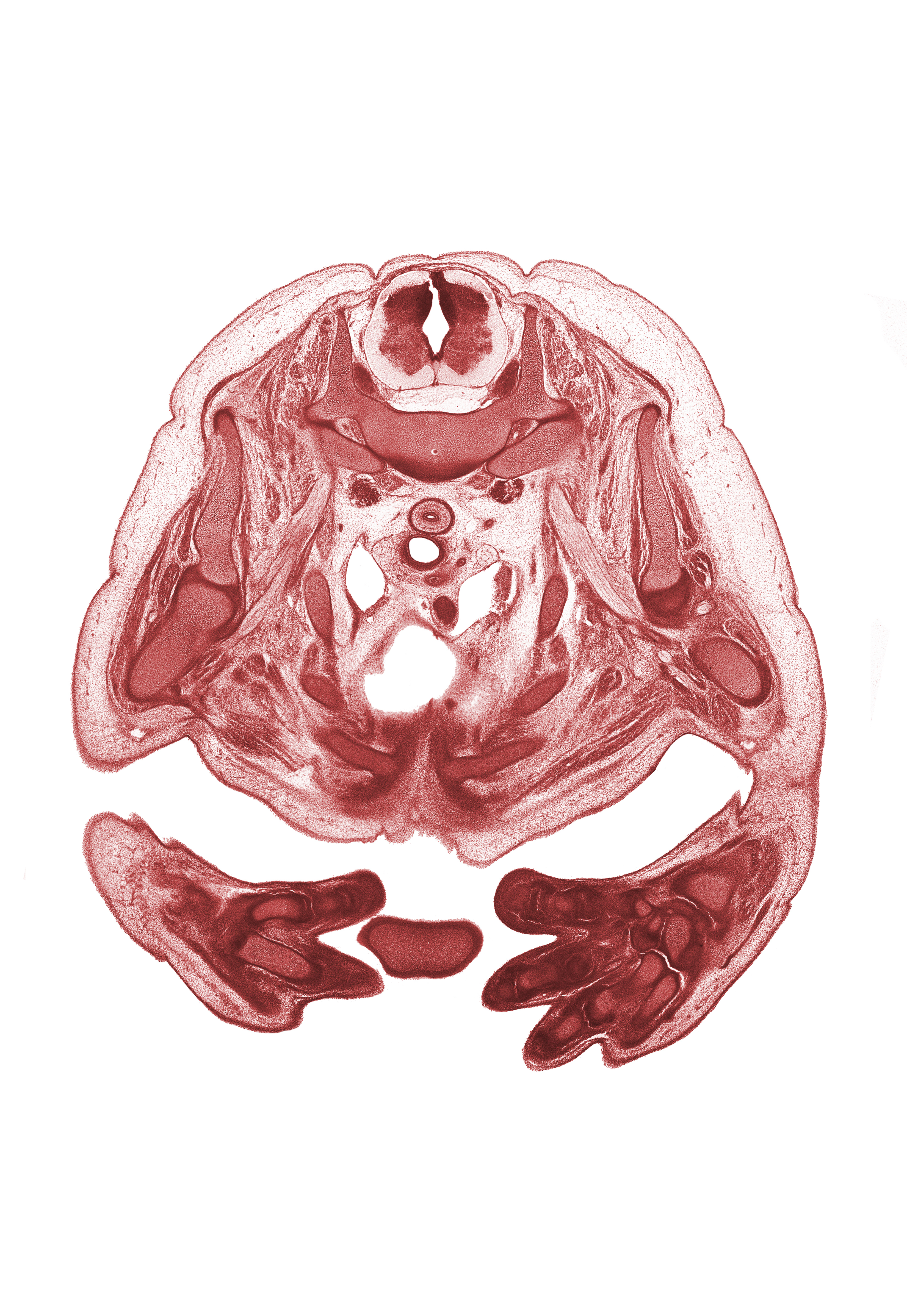 T-2 / T-3 interganglion region, ascending aorta, auricle of left atrium, auricle of right atrium, central canal, heart prominence, interventricular sulcus, left hand, left vagus nerve (CN X), left ventricle, neural arch, rib 3, rib 4, rib 5, rib 6, rib 7, right pulmonary artery, right vagus nerve (CN X), sulcus limitans, trabecular part of right ventricle, tracheal bifurcation, ulna, upper lobe of left lung