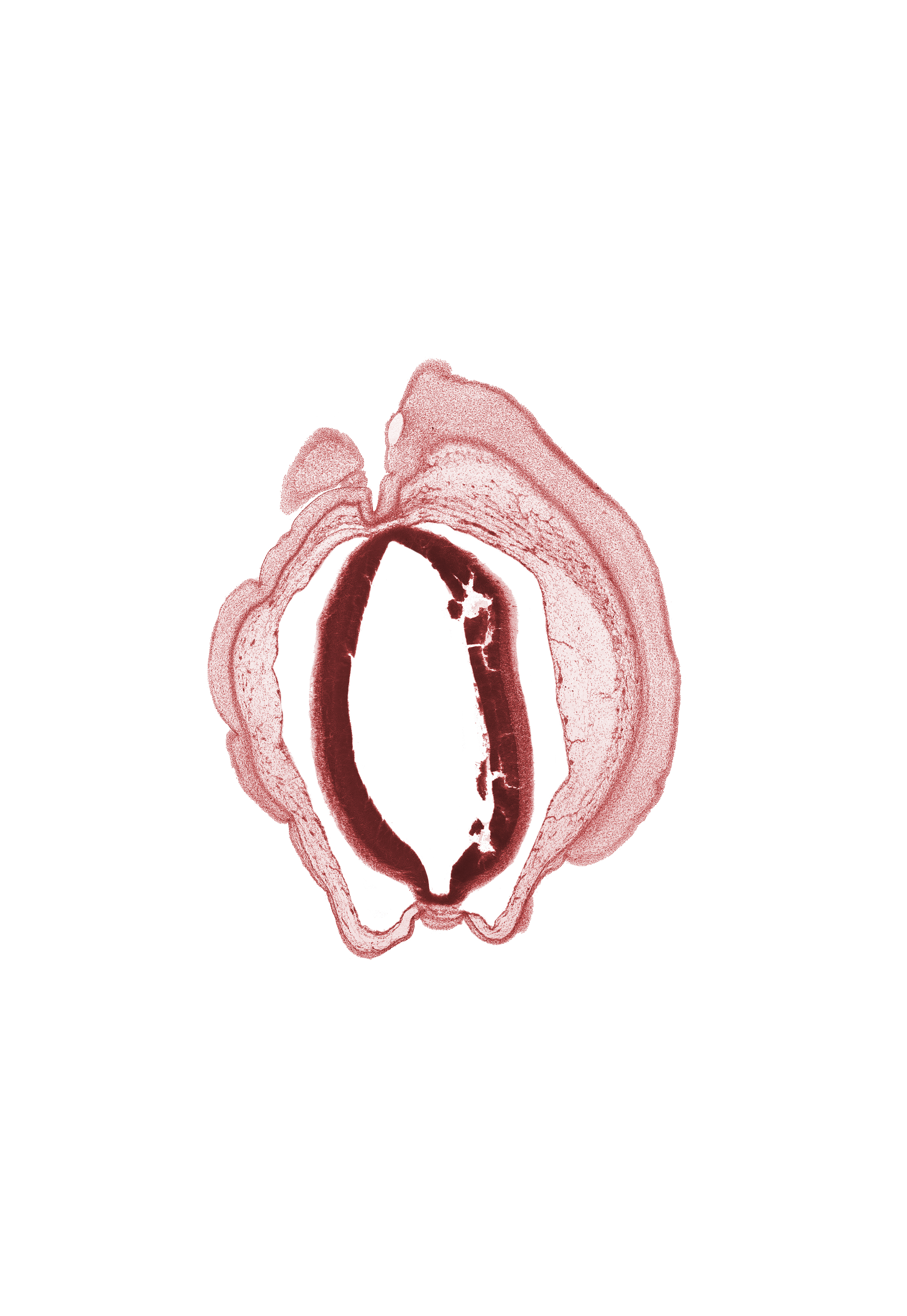 artifact fracture(s), artifact space(s), cerebral aqueduct (longitudinal section), intermediate zone, marginal zone, osteogenic layer, subarachnoid space, ventricular zone