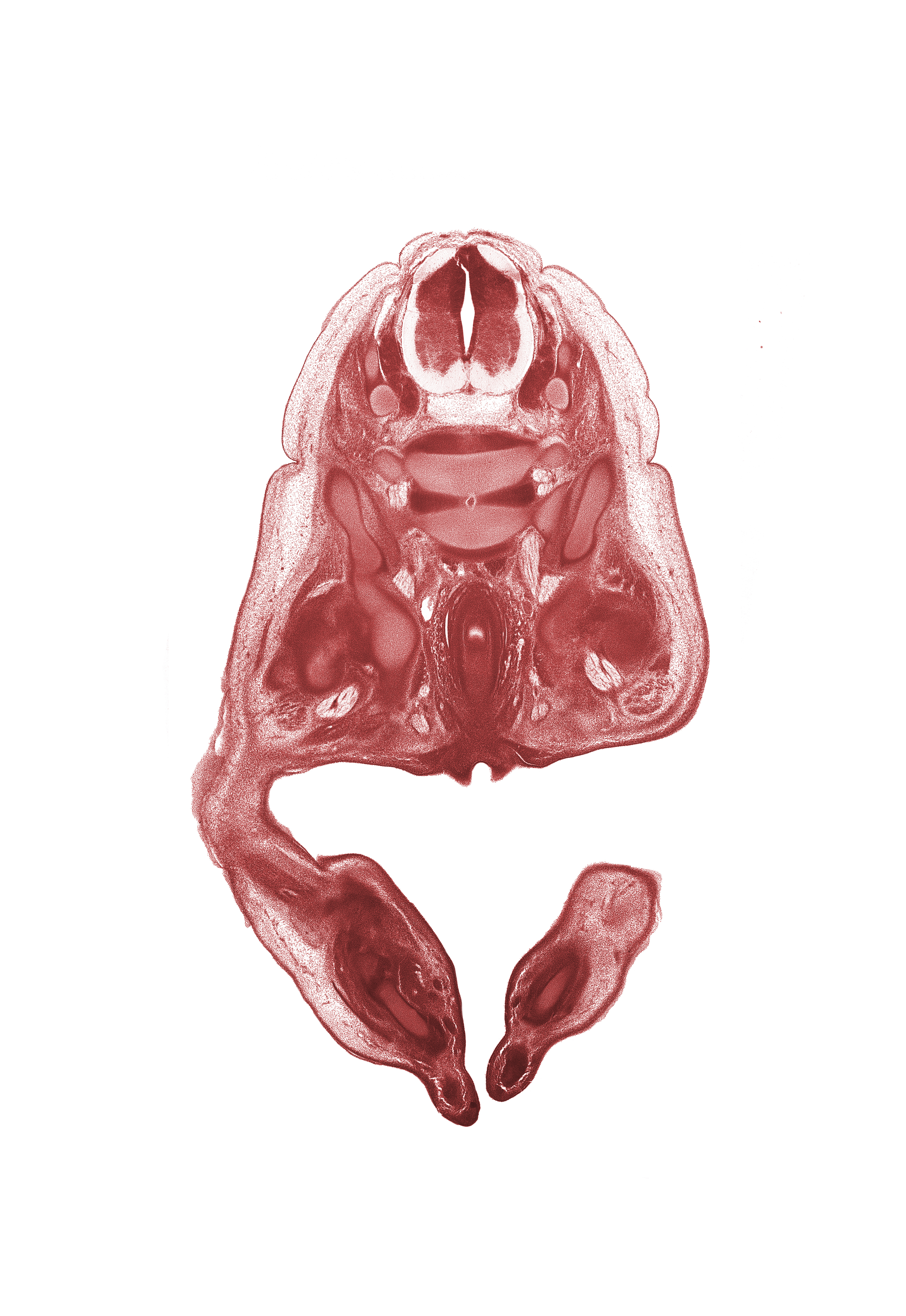 L-4 spinal ganglion, L-4 spinal nerve, L-5 / S-1 intervertebral disc, L-5 ventral primary ramus, alar plate(s), anal fold, anal pit, artifact fracture(s), basal plate, dorsum of foot, floor plate, iliacus muscle, notochord, pelvic plexus, plantar surface of foot, rectum, roof plate, sciatic nerve, sulcus limitans
