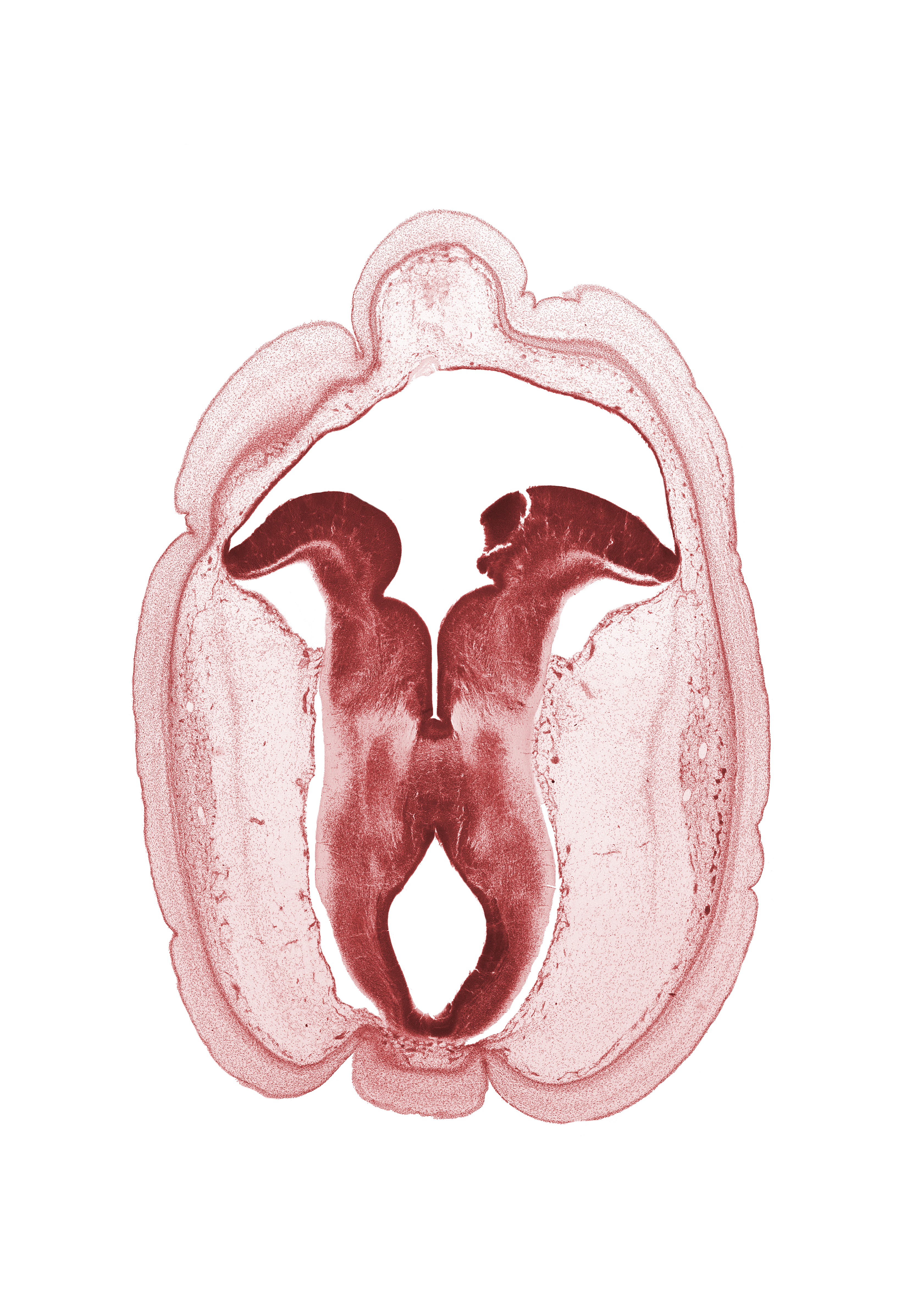 artifact fracture(s), cerebral aqueduct (mesocoele), fiber tract in basal plate, floor plate, head mesenchyme, median sulcus, rhombencoel (fourth ventricle), subarachnoid space, sulcus limitans, tectum of mesencephalon, tegmentum of mesencephalon, trochlear nerve (CN IV)