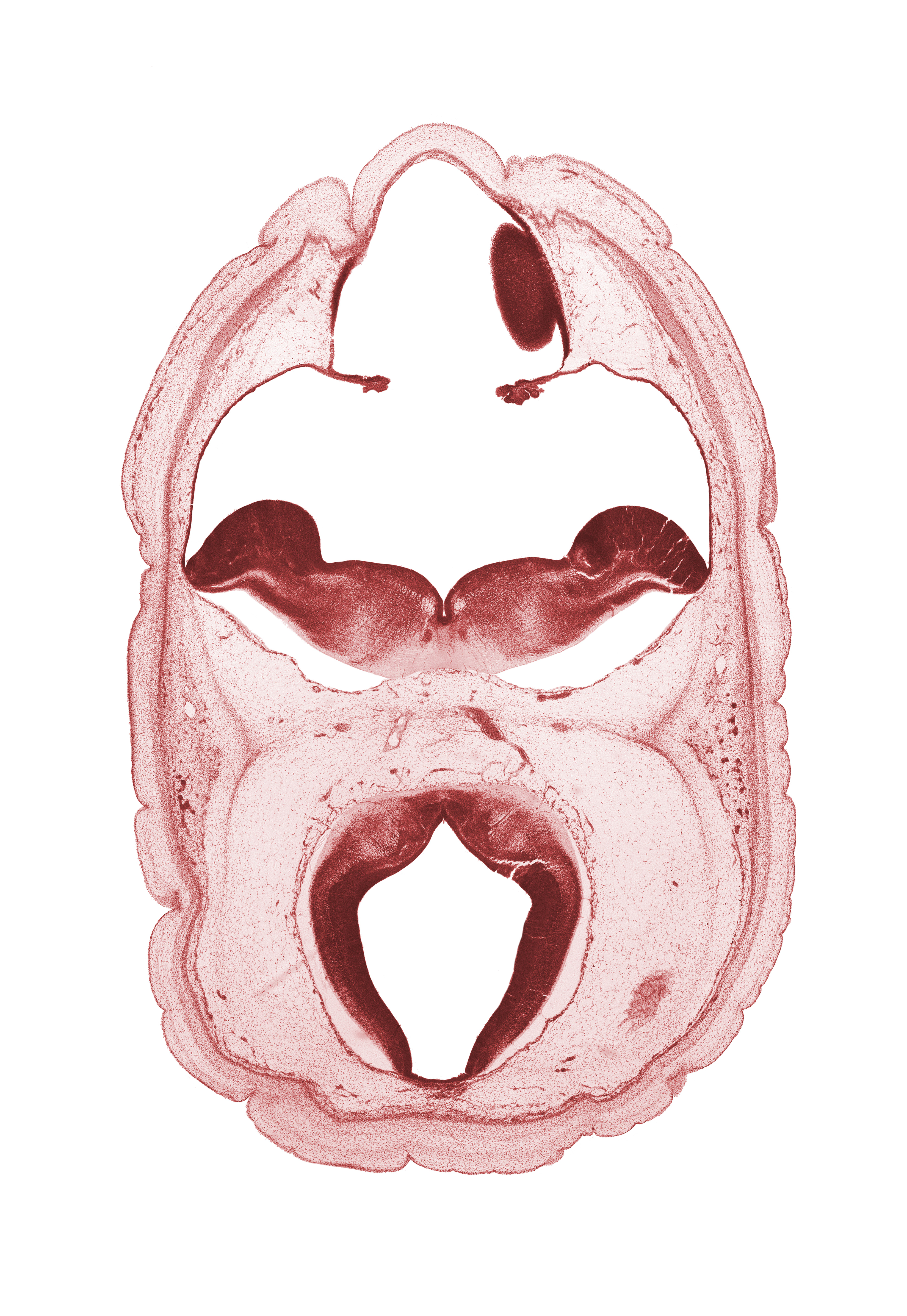 alar plate of metencephalon (cerebellum), artifact space(s), choroid plexus, diverticulum of rhombencoel (fourth ventricle), edge of cerebral vesicle (hemisphere), metencephalon, myelencephalon, oculomotor nerve (CN III), rhombencoel (fourth ventricle), roof plate, subarachnoid space, tectum of mesencephalon, trochlear nerve (CN IV), vascular plexus