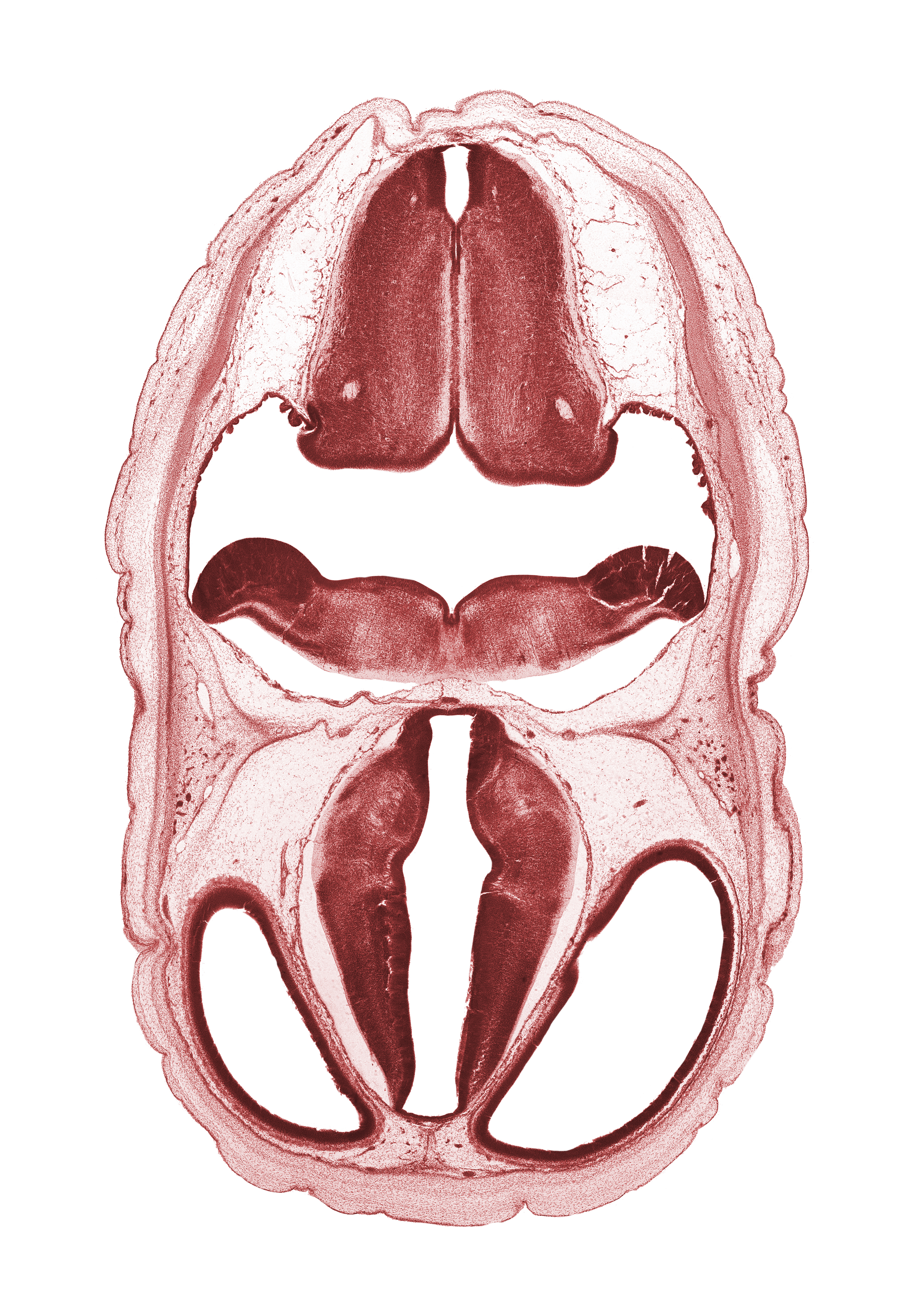 alar plate(s), basal plate, basilar artery, decussation, dorsal thalamus, edge of endolymphatic duct, exoccipital, floor plate, floor plate of diencephalon, hypothalamic sulcus, hypothalamus, lateral ventricle, median sulcus, roof plate of diencephalon, roof plate of myelencephalon, subarachnoid space, sulcus dorsalis, third ventricle, venous plexus(es), ventral thalamus