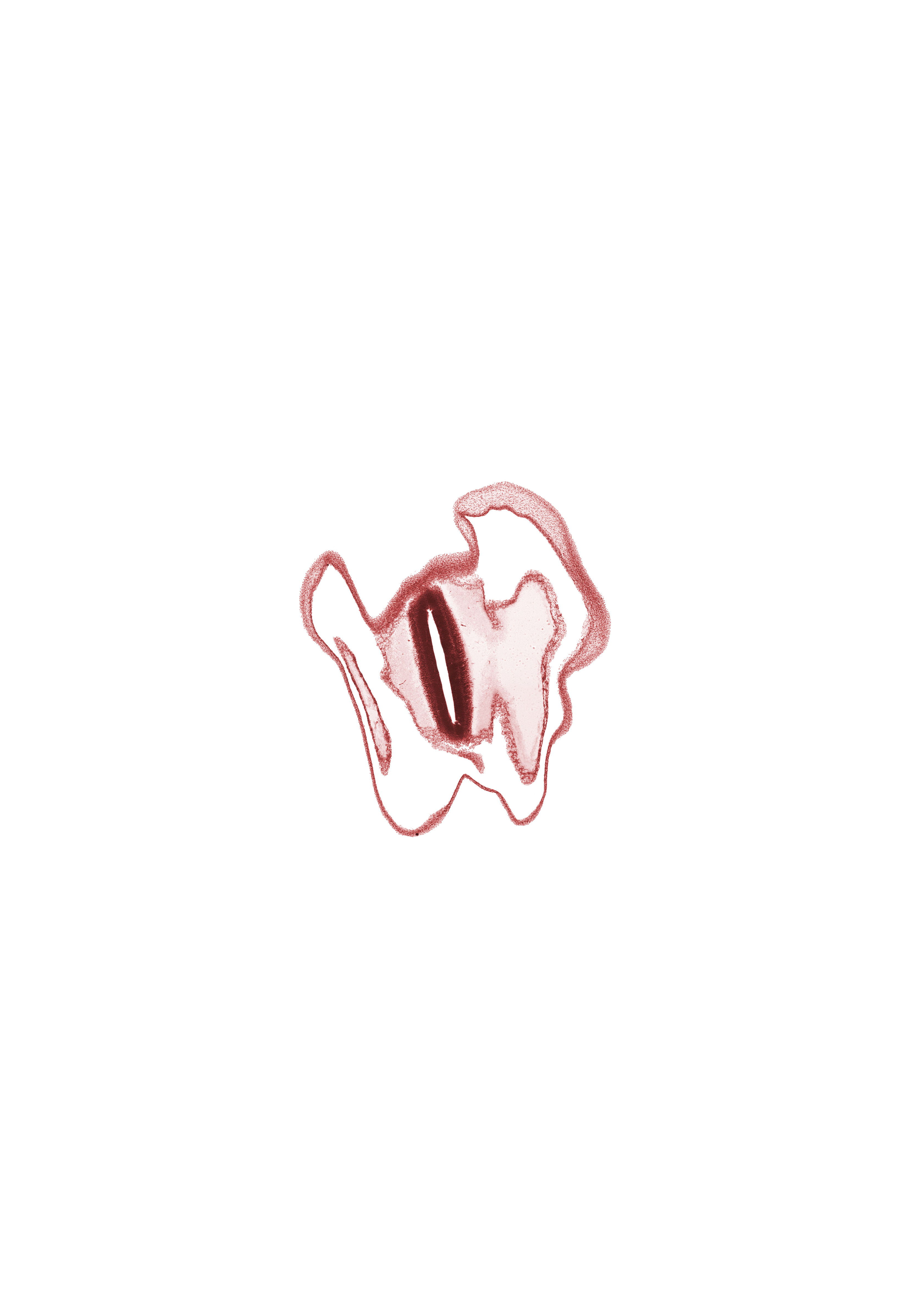 artifact space(s), osteogenic layer, roof plate of mesencephalon, subarachnoid space, vascular plexus