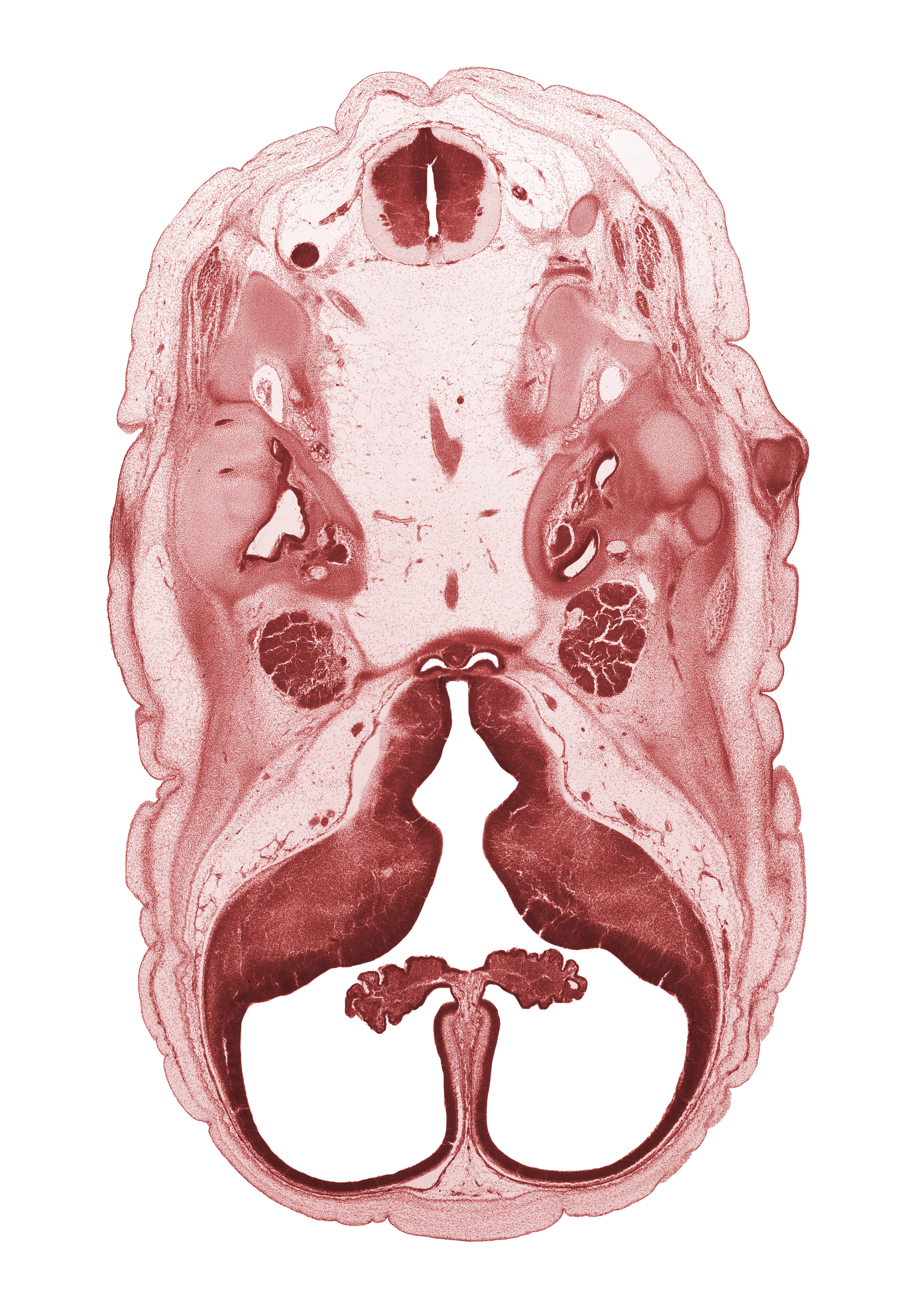 C-1 spinal nerve, abducens nerve (CN VI), basilar artery, central canal, cerebral vesicle (hemisphere), choroid plexus, cochlear duct, facial nerve (CN VII), falx cerebri region, head mesenchyme, hypoglossal nerve (CN XII), interventricular foramen, junction of basilar artery and vertebral arteries, lateral ventricle, lateral ventricular eminence (telencephalon), medial ventricular eminence (diencephalon), neurohypophysis, otic capsule cartilage, pharyngeal arch 1 cartilage (Meckel), posterior communicating artery, subarachnoid space, trigeminal ganglion (CN V), utricle, venous plexus(es), vertebral artery