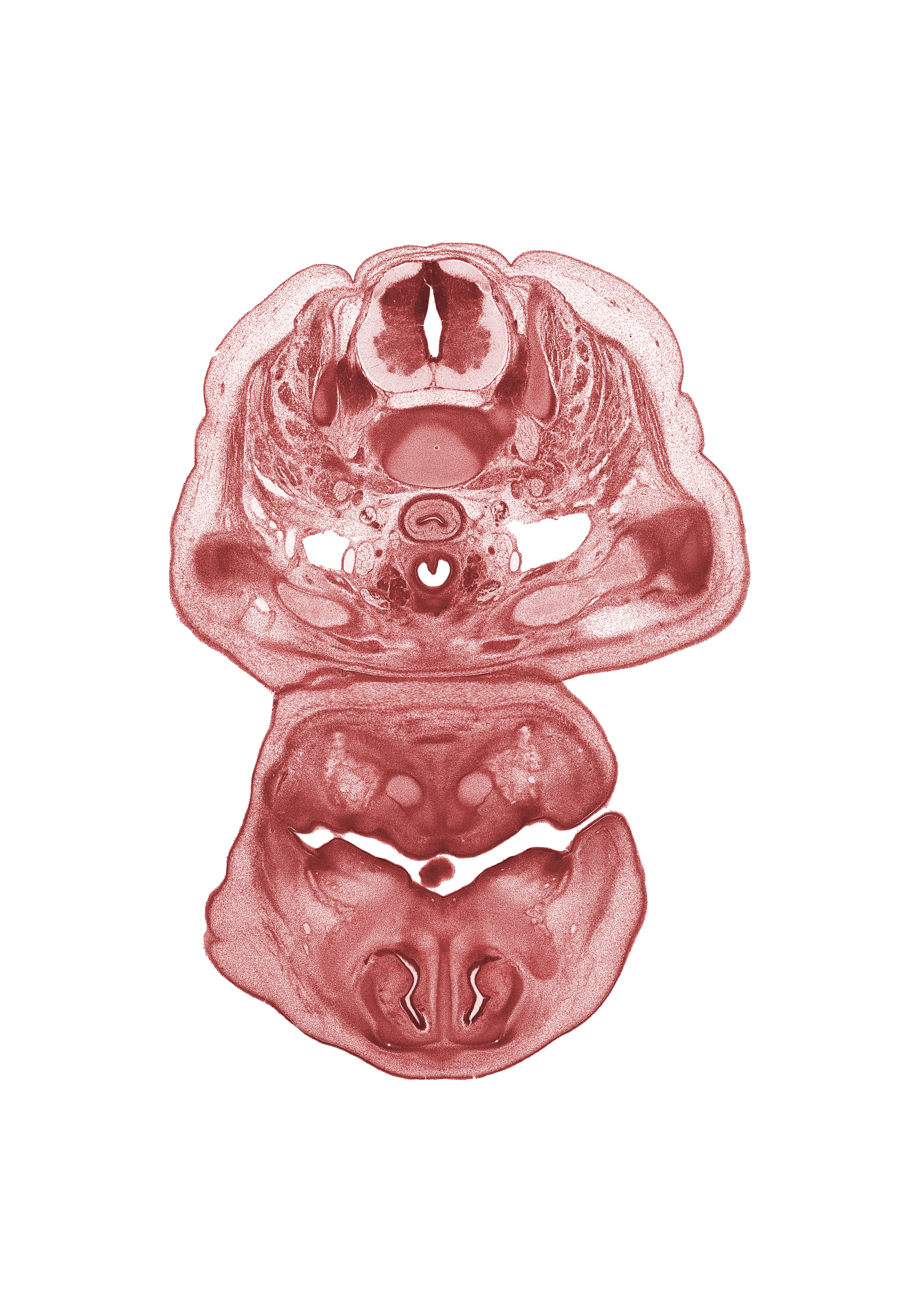 C-5 / C-6 intervertebral disc, C-6 spinal ganglion, C-6 spinal nerve, acromion process of scapula, angle of mouth, clavicle, esophagus, inferior nasal concha, nasal capsule cartilage condensation, nasal cavity (nasal sac), nasal septal cartilage, neural arch, oral cavity, pharyngeal arch 1 cartilage (Meckel), platysma muscle, primary palate, semispinalis capitis muscle, semispinalis cervicis muscle, splenius muscle, thyroid gland, tip of tongue, trachea, trapezius muscle, vagus nerve (CN X)