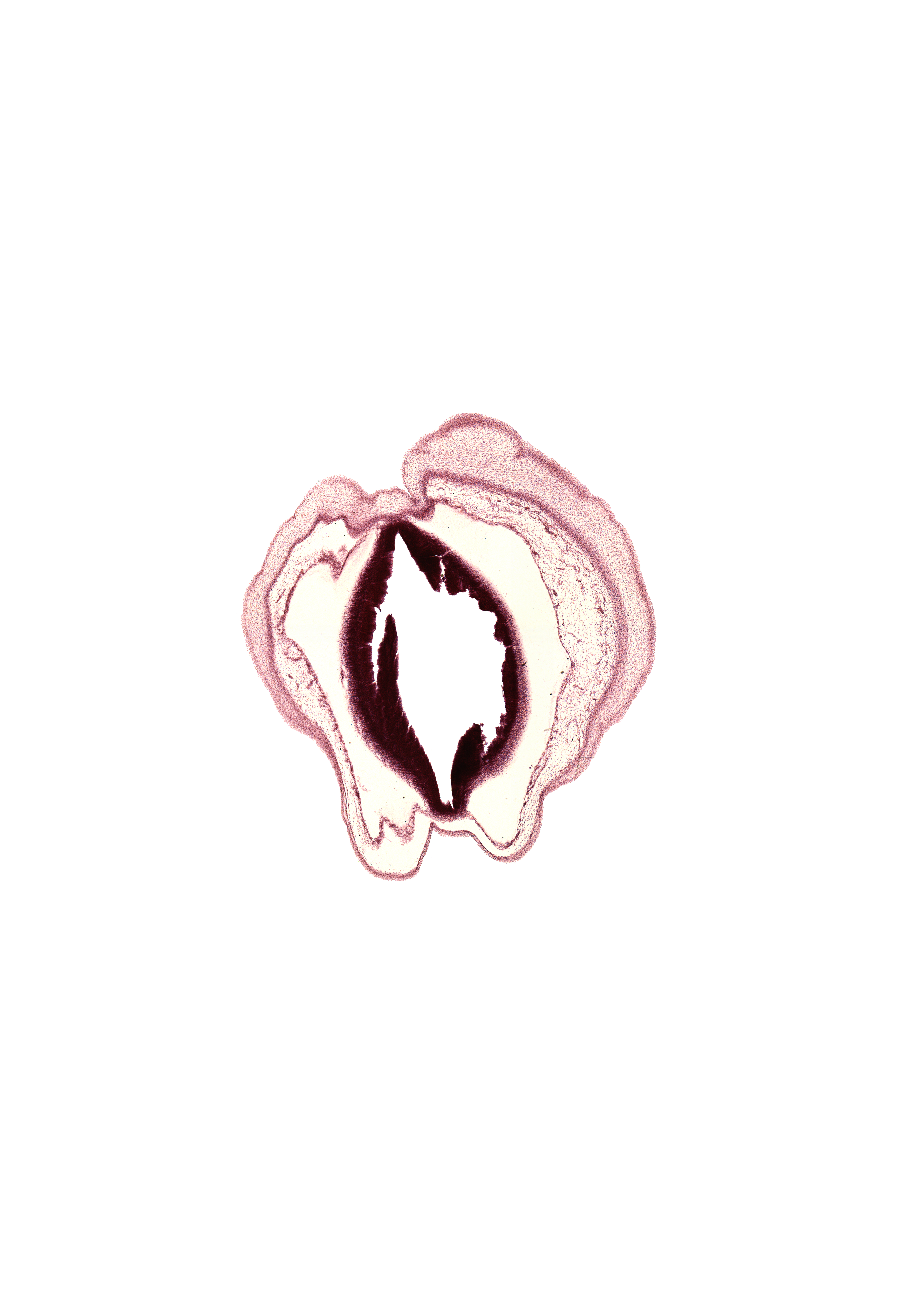 artifact fracture(s), artifact separation(s), cerebral aqueduct (mesocoele), head mesenchyme, osteogenic layer, subarachnoid space, surface ectoderm