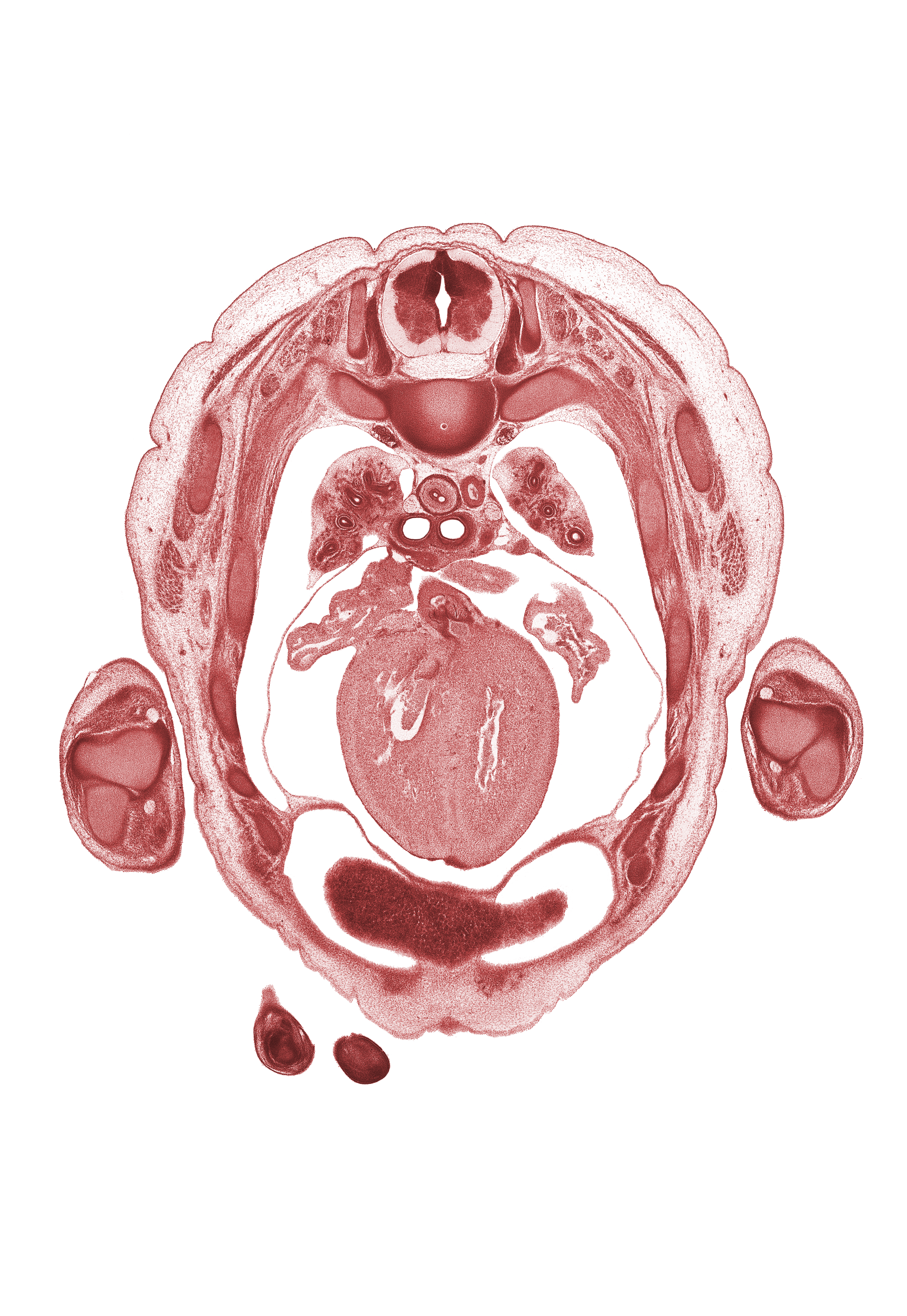 T-3 spinal ganglion, aorta, auricle of left atrium, auricle of right atrium, cephalic edge of liver, digits (fingers), extensor muscles in forearm, head of rib 4, iliocostalis muscle, junction of right atrium and superior vena cava, longissimus muscle, muscular interventricular septum, primary bronchus, spinalis muscle, trabecular part of left ventricle, trabecular part of right ventricle, ulna, ulnar nerve, upper lobe of left lung, upper lobe of right lung