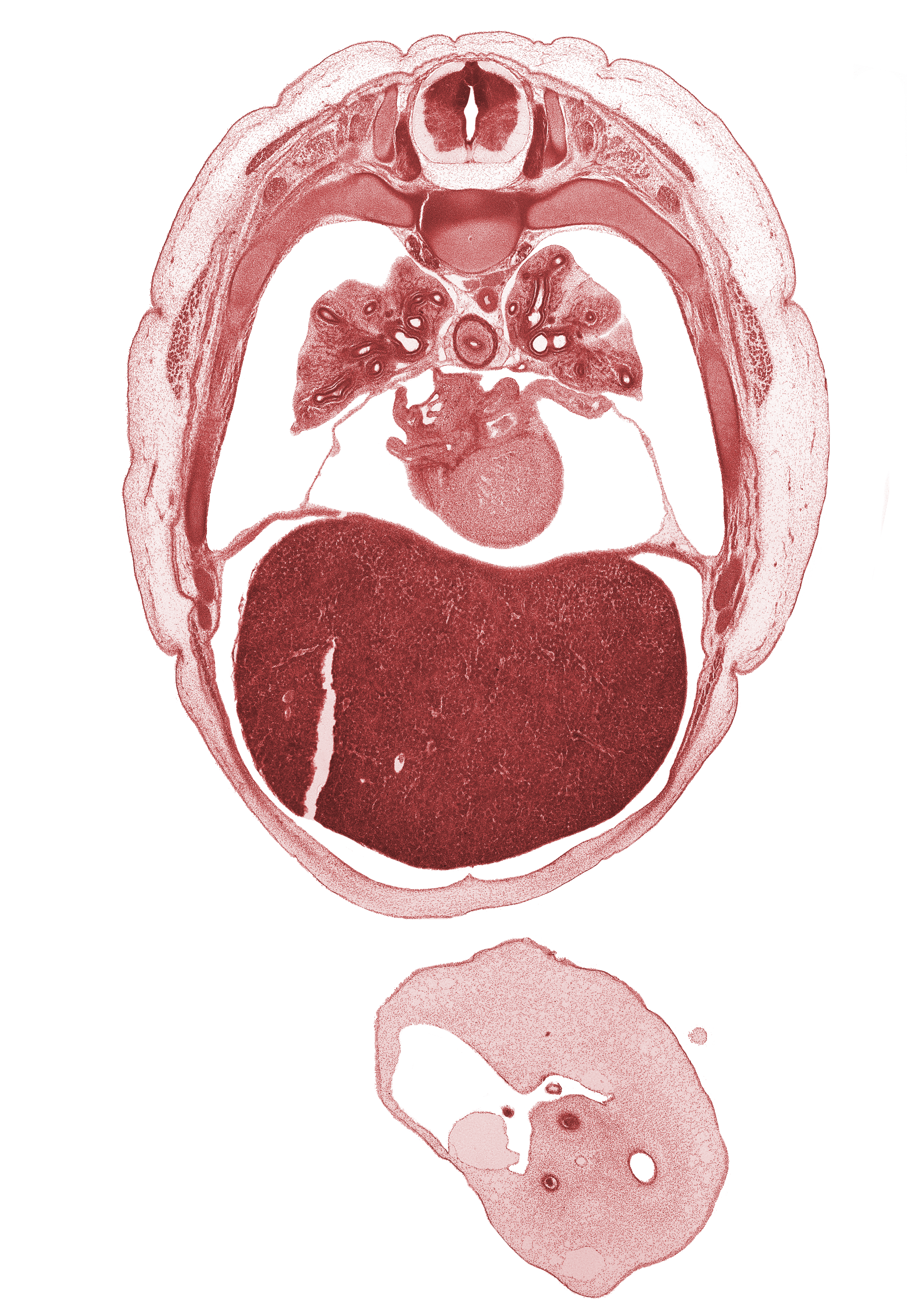 T-5 spinal ganglion, allantois, amnion on surface of umbilical cord, aorta, apex of heart, artifact separation(s), esophagus, latissimus dorsi muscle, left atrium, left lobe of liver, left lower pulmonary vein, left umbilical artery, left ventricle, lower secondary bronchus, oblique pericardial sinus, rib 6, rib 7, rib 8, rib 9, right lobe of liver, right umbilical artery, trapezius muscle, umbilical vein