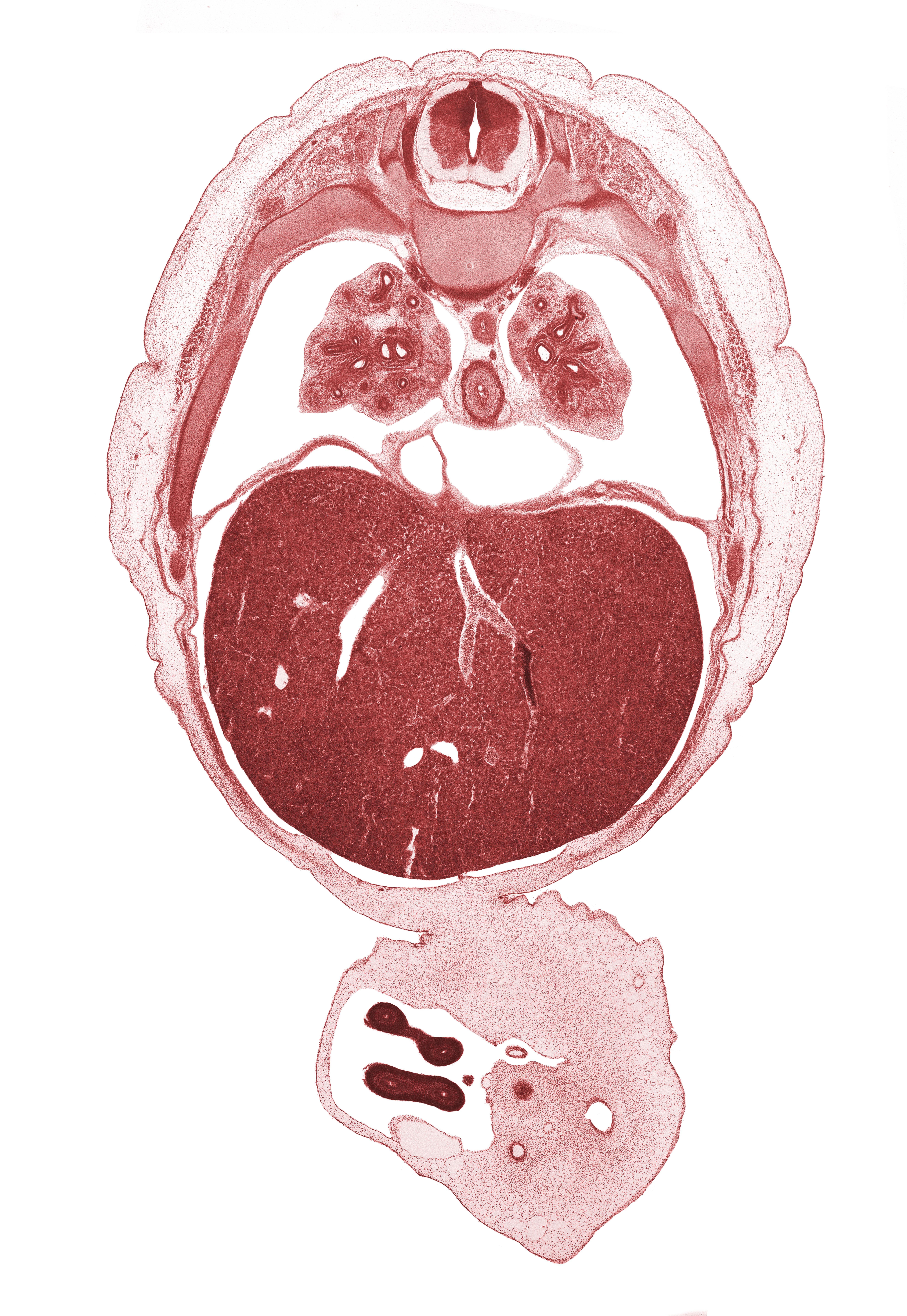 T-6 / T-7 interganglion region, aorta, artifact fracture(s), cyst, distal limb of herniated midgut, external abdominal oblique muscle, inferior vena cava, lower lobe of right lung, notochord, pericardial cavity, pericardial sac, proximal limb of herniated midgut, rib 8, rib 9, sympathetic trunk, umbilical cord