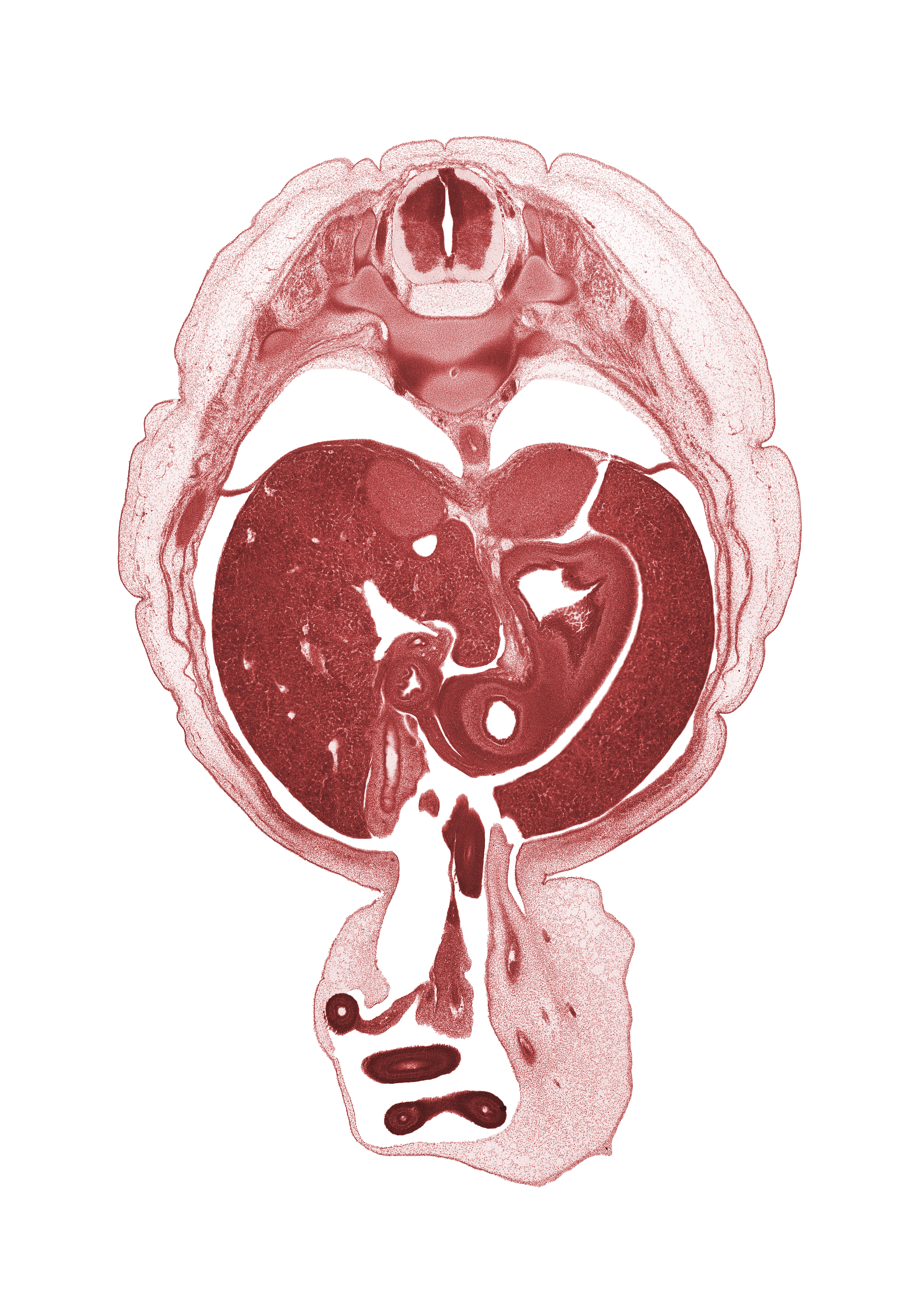 T-10 spinal ganglion, aorta, caudate lobe of liver, distal limb of herniated midgut, duodenum, gall bladder, head of rib 11, left umbilical artery, lesser curvature of stomach, lesser sac (omental bursa), mesentery, proximal limb of herniated midgut, pyloric antrum of stomach, right umbilical artery, sympathetic trunk