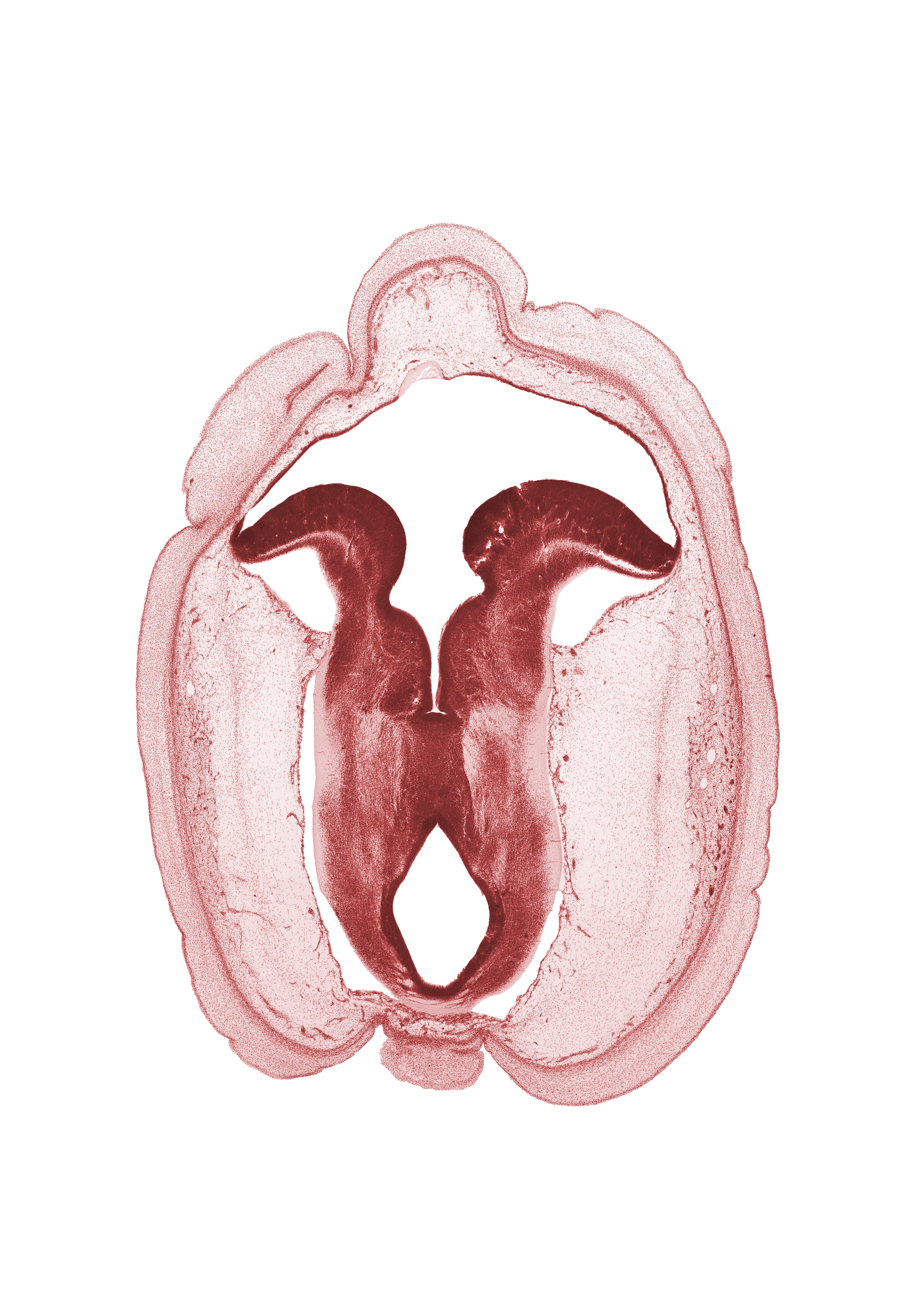 cerebral aqueduct (mesocoele), commissure in roof plate of mesencephalon, fiber tract, floor plate, head mesenchyme, middle dural venous plexus, osteogenic layer, roof plate of metencephalon, subarachnoid space, surface ectoderm, trochlear nerve (CN IV)