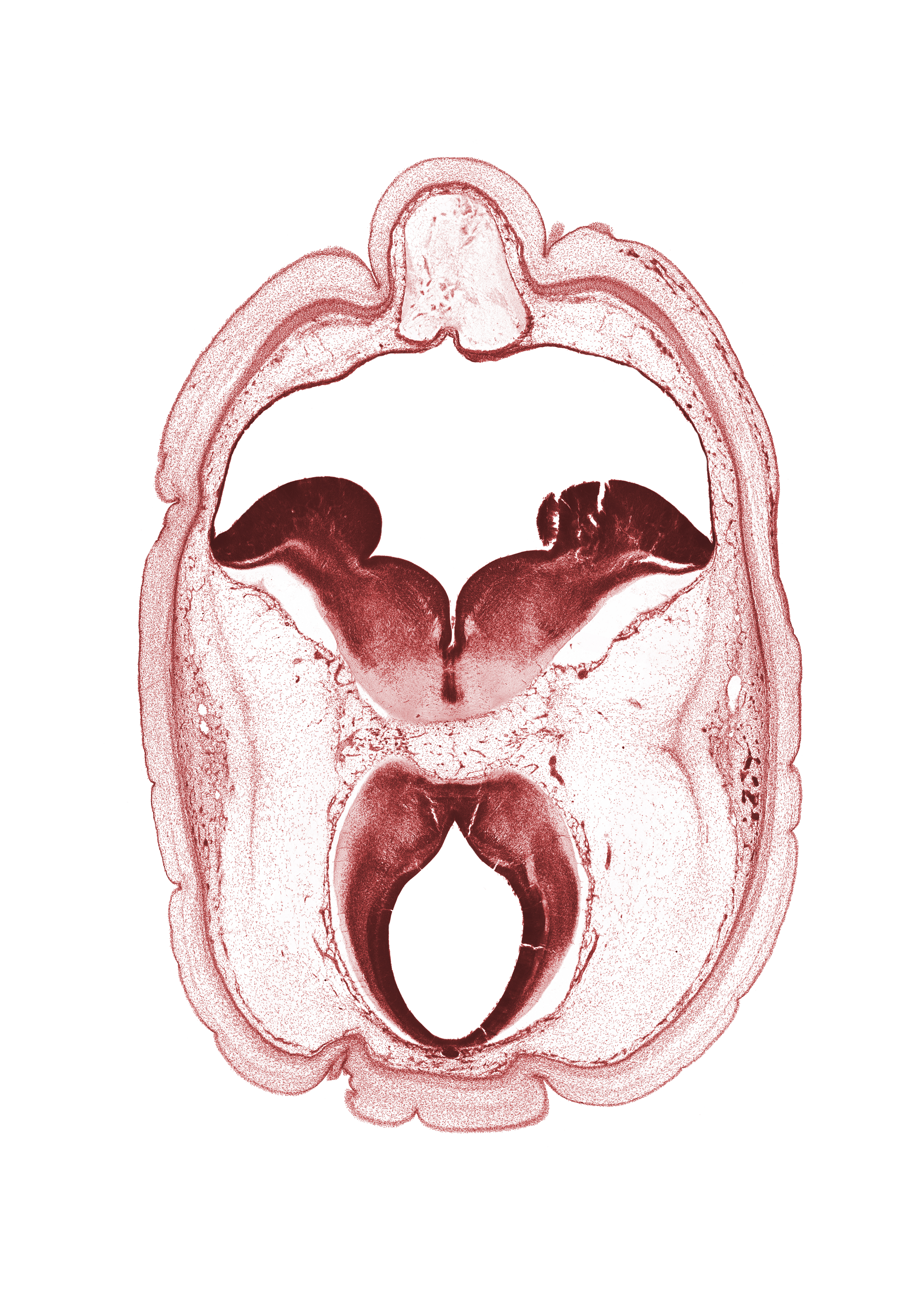 artifact fracture(s), artifact space(s), cephalic part of dural band for tentorium cerebelli, cerebral aqueduct (mesocoele), osteogenic layer, pons region (metencephalon), region of mesencephalic (cephalic) flexure, rhombencoel (fourth ventricle), root of oculomotor nerve (CN III), subarachnoid space, superficial vascular plexus