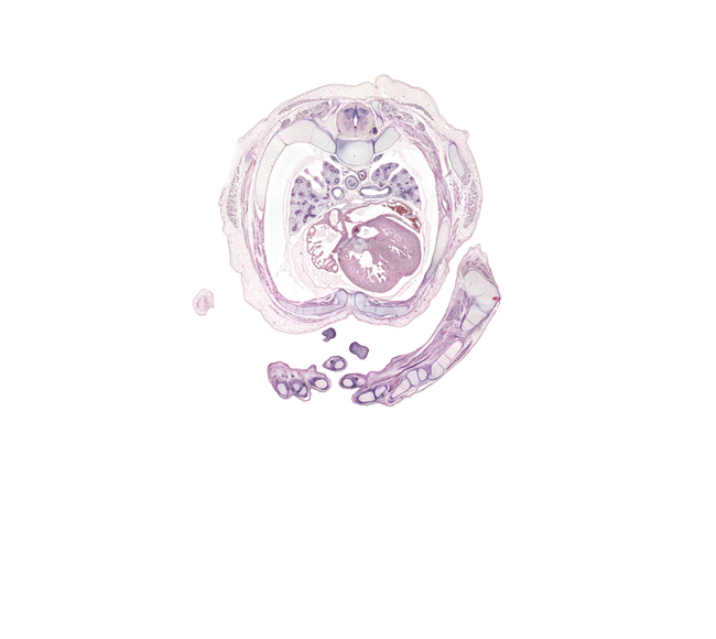 T-4 intercostal nerve, T-4 spinal ganglion, aorta, aortic vestibule of left ventricle, artifact(s), digit 5 (little finger), edge of elbow, head of rib 5, hypothenar eminence, intermediate phalynx of digit 2 (index finger), junction of sinus venosus of right atrium and superior vena cava, latissimus dorsi muscle, left atrium, lower lobe of left lung, lumbrical muscle, metacarpal 3, metacarpal 4, metacarpophalangeal joint of digit 4 (ring finger), muscular interventricular septum, notochord, palm, posterior intercostal artery, pulmogenic mesenchyme, rib 5, rib 6, styloid process of ulna, tip of left digit 1 (thumb), trabecular part of left ventricle, trapezius muscle