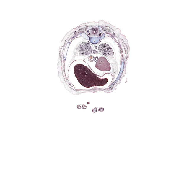 T-6 spinal ganglion, caudal edge of elbow, coronary sinus, costal margin, costovertebral joint, dorsal horn of grey matter, falciform ligament, inferior vena cava, lateral horn of grey matter, left lobe of liver, linea alba, loose mesenchyme, notochord, pericardial sac, phrenic nerve, pleural cavity, right lobe of liver, serratus anterior muscle, trapezius muscle, ventral horn of grey matter, volar surface of left digit 4 (ring finger)