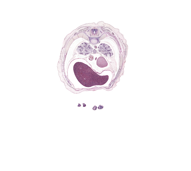 T-6 / T-7 interganglion region, T-6 / T-7 intervertebral disc, caudal edge of coronary sinus, caudal edge of upper lobe of left lung, central canal, costal margin, distal phalynx of left digit 5 (little finger), esophageal nerve plexus, head of rib 7, latissimus dorsi muscle, left lobe of liver, left ventricle, middle lobe of right lung, neural arch, oblique fissure, pericardial cavity, peritoneal cavity, rib 7, rib 8, rib 9, right lobe of liver, sympathetic trunk, trapezius muscle