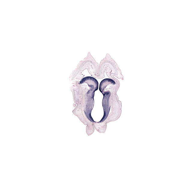 artifact space(s), artifact(s), cerebral aqueduct (mesocoele), commissure of superior colliculus, isthmic canal, isthmic nucleus, rhombencoel (fourth ventricle), subarachnoid space, sulcus limitans, superior colliculus region, trochlear nerve tract