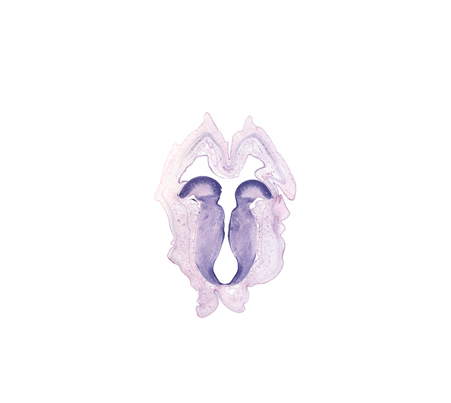 artifact space(s), basal plate of mesencephalon, cerebral aqueduct (mesocoele), exoccipital, head mesenchyme, oculomotor nucleus, osteogenic layer, rhombencoel (fourth ventricle), roof plate, subarachnoid space, sulcus limitans, surface ectoderm, tectum of mesencephalon, trochlear nucleus, vestibular area