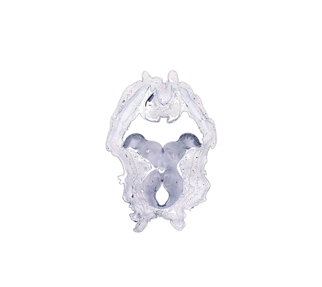 artifact(s), caudal part of third ventricle, cerebral peduncle, edge of myelencephalon, exoccipital, external cerebellum, internal cerebellum, interpeduncular fossa, posterior commissure, rhombencoel (fourth ventricle), sulcus limitans