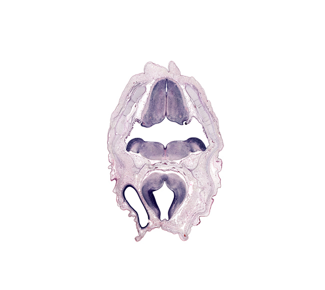 artifact space(s), basilar artery, cephalic edge of endolymphatic sac, cerebral vesicle (hemisphere), dural band for tentorium cerebelli, hypoglossal nucleus, intermediate zone, marginal zone, middle dural venous plexus, myelencephalon (medulla oblongata), osteogenic layer, rhombencoel (fourth ventricle), sulcus limitans, tegmentum of pons, tract of vestibulocochlear nerve (CN VIII), ventricular zone