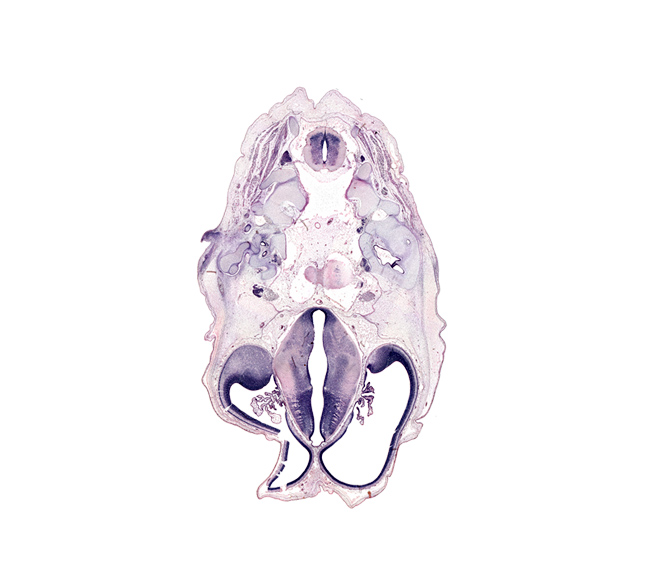 C-2 spinal ganglion, accessory nerve (CN XI), basi-occipital (basal plate), basilar artery, decussation, dorsal median septum, dorsal thalamus, edge of pons region (metencephalon), foramen magnum region, glossopharyngeal nerve (CN IX), hypoglossal nerve (CN XII), hypothalamic sulcus, hypothalamus, lateral mass of C-1 vertebra (atlas), lateral semicircular duct, marginal ridge, oculomotor nerve (CN III), posterior arch of C-2 vertebra (axis), posterior communicating artery, roof plate of diencephalon, root of trigeminal nerve (CN V), sulcus dorsalis, sulcus medius, trochlear nerve (CN IV), utricle, vagus nerve (CN X), ventral median sulcus, ventral thalamus, vertebral artery