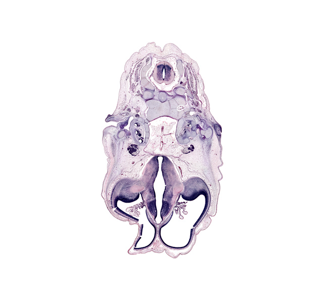 C-2 spinal ganglion, artifact fracture(s), atlanto-occipital joint, basi-occipital (basal plate), basilar artery, cephalic edge of auricle, choroid fissure, choroid plexus, cortical plate, dens of C-2 vertebra (axis), external acoustic meatus, glossopharyngeal nerve (CN IX), hippocampus, hypothalamic sulcus, hypothalamus, incus, internal capsule, lateral ventricle, pharyngeal arch 1 cartilage (Meckel), posterior arch of C-2 vertebra (axis), posterior communicating artery, spinal accessory nerve (CN XI), splenius muscle, stapes, subarachnoid space, trigeminal ganglion (CN V), vagus and accessory nerves (CN X and CN XI)