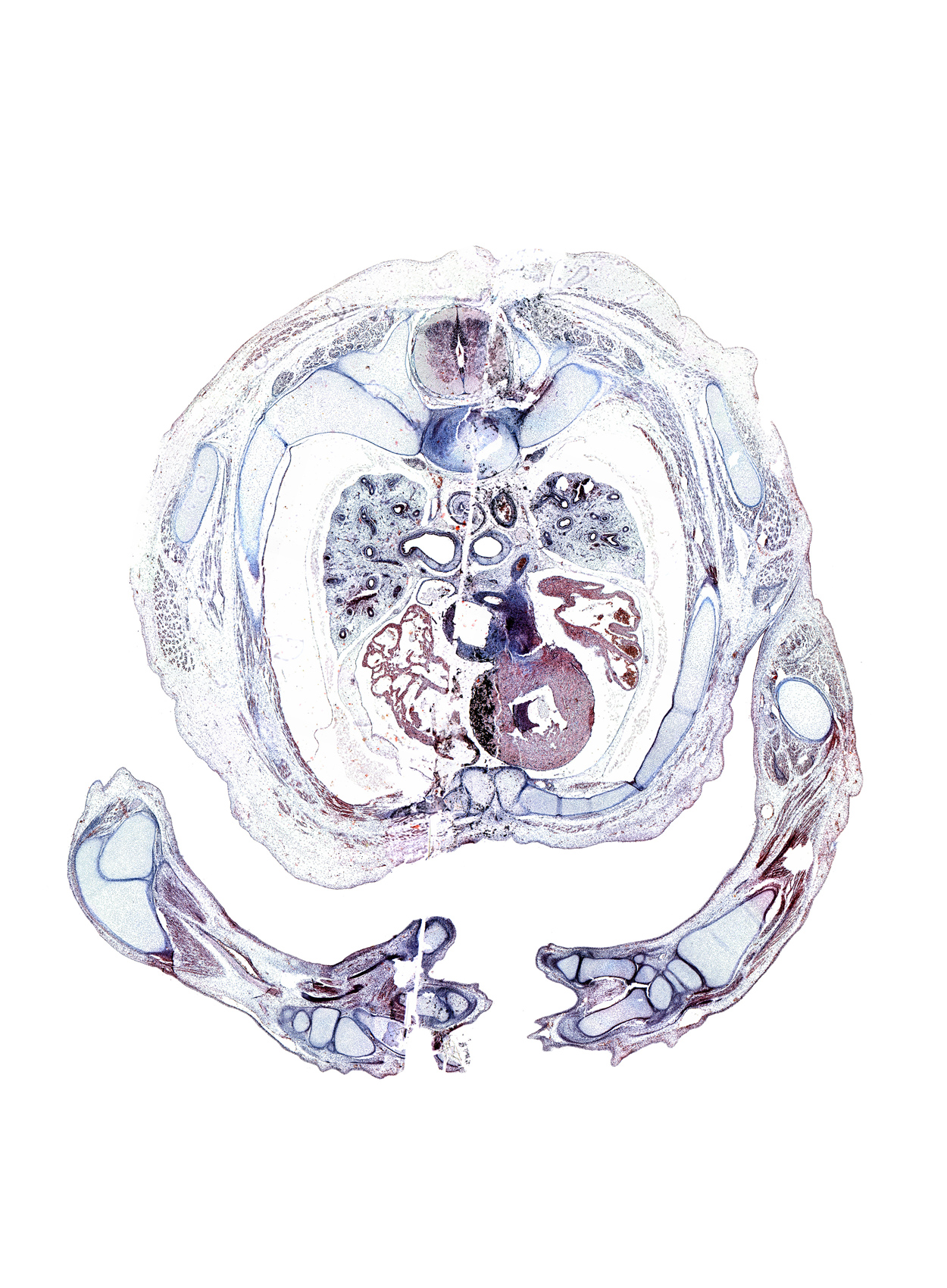 T-3 / T-4 interganglion region, artifact(s), edge of ulna, hamate, humerus, iliocostalis muscle, latissimus dorsi muscle, longissimus muscle, metacarpal 4, olecranon process of ulna, pulmogenic mesenchyme, radius, rhomboid major muscle, rib 4, scapula, spinalis muscle, triceps brachii tendon, triquetrum, trochlea of humerus, ulna, upper secondary bronchus