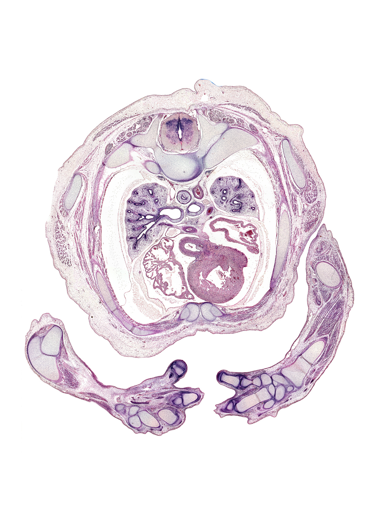 T-3 / T-4 interganglion region, eparterial bronchus, hamate, interventricular sulcus, left atrium, left primary bronchus, left pulmonary artery, left ventricle, metacarpal 2, metacarpal 3, metacarpal 5, pisiform, proximal metacarpophalangeal joint, radius, rhomboid major muscle, rib 4, right atrium, right pulmonary artery, right ventricle, superior vena cava, transverse process, triceps brachii muscle