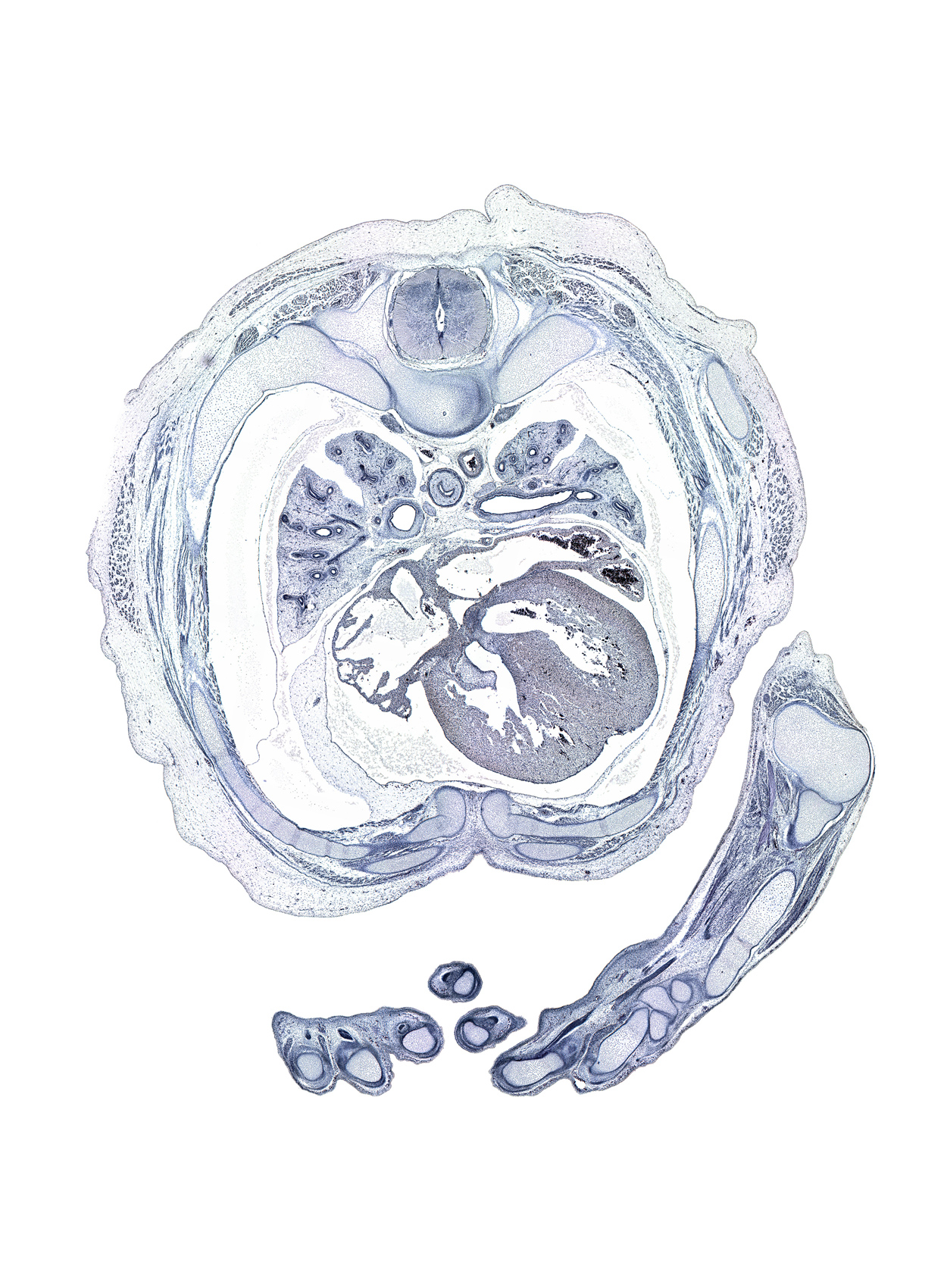 T-4 / T-5 interganglion region, aponeurosis of external abdominal oblique muscle, central canal, distal end of ulna, dorsum of hand, external intercostal muscle(s), head of radius, head of rib 5, hemisternum, humerus, iliocostalis muscle, inferior tertiary bronchus, innermost intercostal muscle(s), intermediate phalynx of left digit 2 (index finger), latissimus dorsi muscle, longissimus muscle, metacarpal 4, musculi pectinati, oblique fissure, pleural cavity, proximal phalynx of digit 3 (middle finger), radiohumeral joint, rib 5, rib 6, rib 7, serratus anterior muscle, sinus venosus, spinalis muscle, sternocostal muscle, sympathetic trunk, upper lobe of left lung, upper secondary bronchus