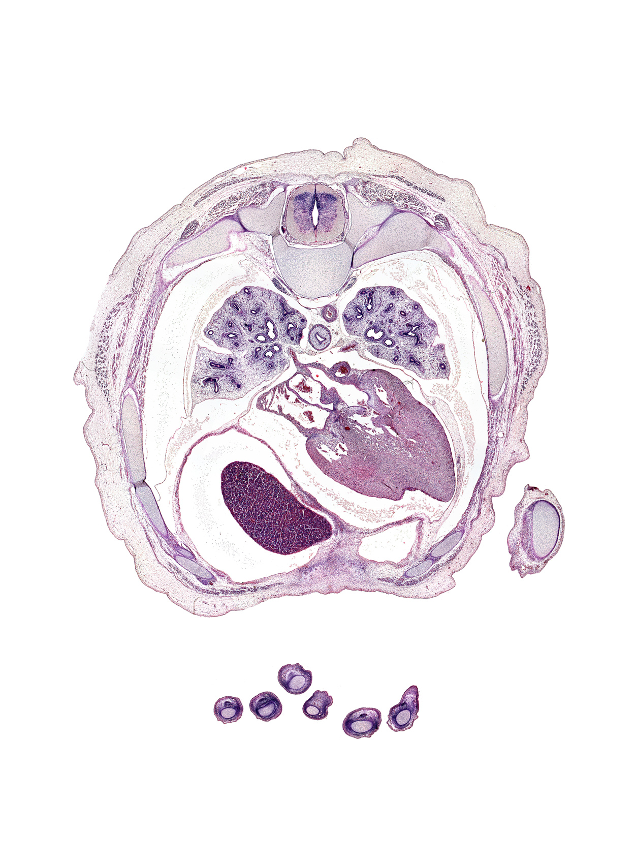 T-5 / T-6 interganglion region, apex of heart, central tendon of diaphragm, coronary sinus, distal phalynx of left digit 3 (middle finger), esophageal nerve plexus, head of rib 6, left lower pulmonary vein, lower lobe of left lung, lower lobe of right lung, middle lobe of right lung, oblique fissure, pericardial cavity, pericardial sac, peritoneal cavity, rib 6, rib 7, rib 8, right lobe of liver, right lower pulmonary vein, upper lobe of left lung
