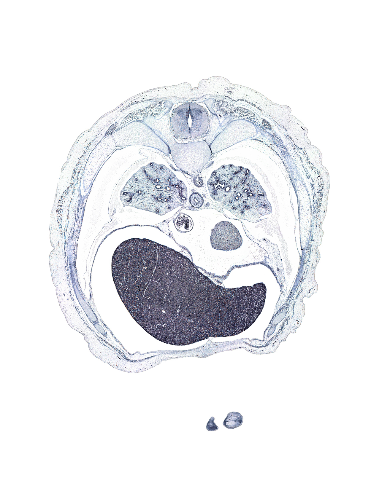 T-6 / T-7 interganglion region, caudal edge of middle lobe of right lung, central tendon of diaphragm, distal phalynx of left digit 5 (little finger), dorsal median septum, falciform ligament, inferior vena cava, latissimus dorsi muscle, left lobe of liver, left ventricle, pericardial sac, peritoneal cavity, pleural recess, rib 7, rib 8, rib 9, right lobe of liver, sympathetic trunk, trapezius muscle, ventral median septum