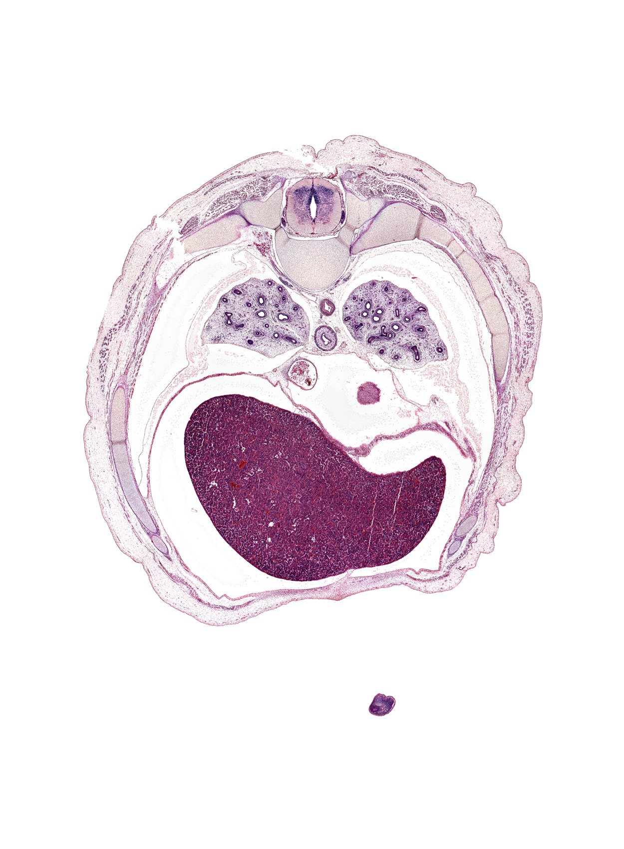 T-7 spinal ganglion, aorta, caudal edge of left ventricle, central tendon of diaphragm, costotransverse joint, costovertebral joint, esophageal nerve plexus, falciform ligament, iliocostalis muscle, inferior vena cava, latissimus dorsi muscle, left lobe of liver, longissimus muscle, lower lobe of left lung, lower lobe of right lung, muscular part of diaphragm, neural arch, pericardial cavity, peritoneal cavity, pulmonary ligament, rib 7, rib 8, rib 9, right lobe of liver, spinalis muscle, tip of digit 5 of left hand (little finger), transverse process of T-7 vertebra