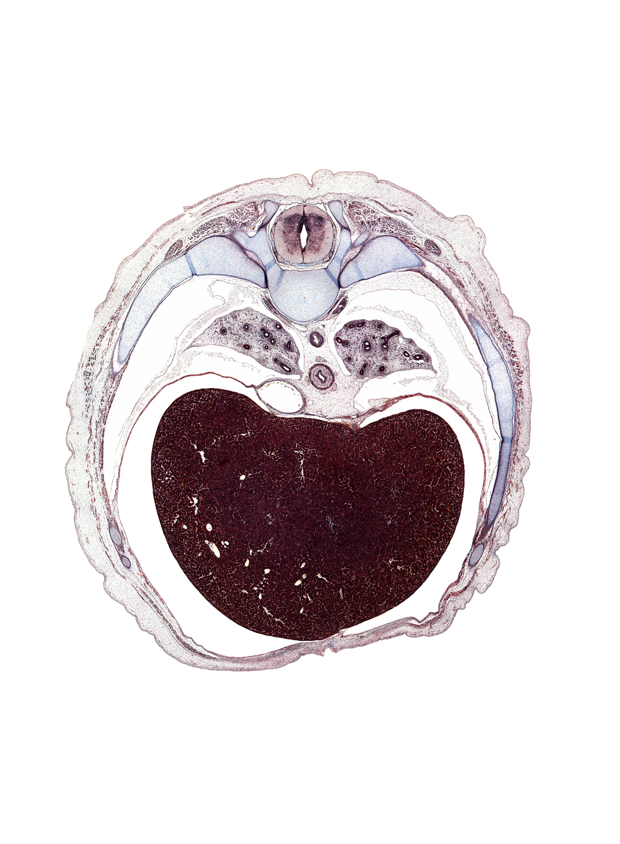 T-7 / T-8 interganglion region, azygos vein, central tendon of diaphragm, esophagus muscularis, inferior vena cava, left lobe of liver, loose mesenchyme, peritoneal cavity, pulmonary ligament, rib 8, rib 9, right lobe of liver, sympathetic trunk, tubercle of rib 8