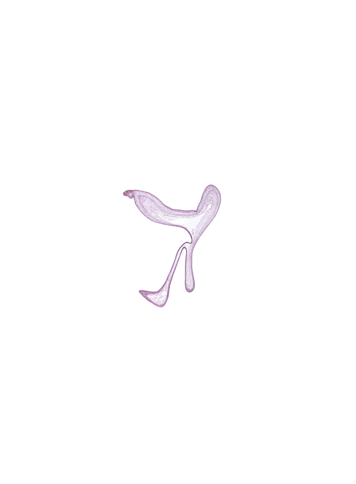 head mesenchyme, surface ectoderm