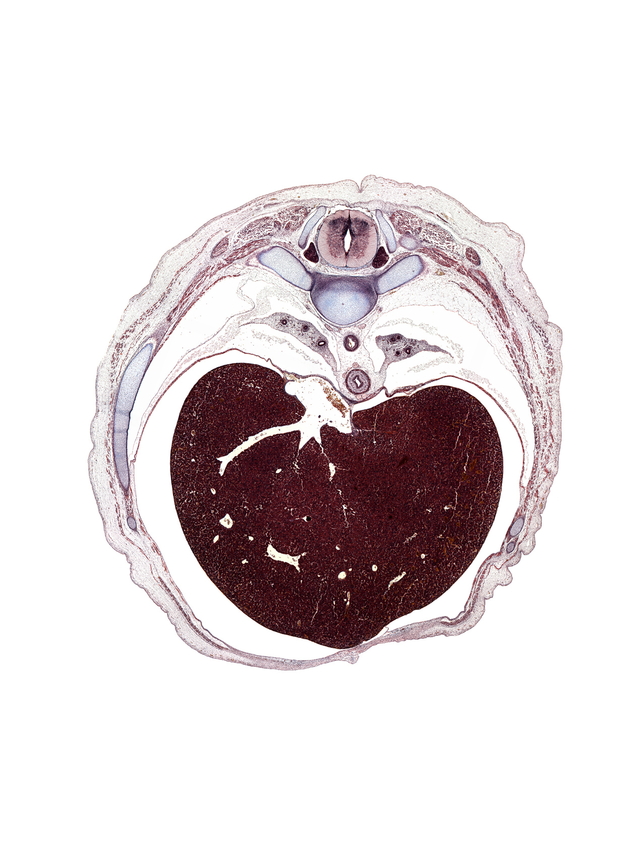 T-8 / T-9 intervertebral disc, T-8 spinal ganglion, costal margin, efferent hepatic veins, head of rib 9, latissimus dorsi muscle, left lobe of liver, loose mesenchyme, lower lobe of left lung, lower lobe of right lung, pleural recess, rib 10, rib 9, right lobe of liver, trapezius muscle