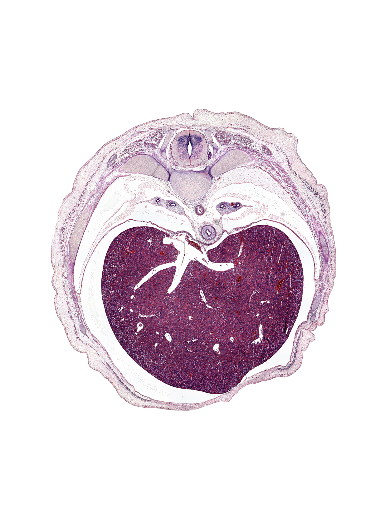 T-8 spinal ganglion, efferent hepatic vein, efferent hepatic veins, esophagus muscularis, head of rib 9, inferior vena cava, left lobe of liver, lower lobe of left lung, lower lobe of right lung, osteogenic layer, peritoneal cavity, pulmonary ligament, rib 10, rib 9, right lobe of liver, supra-umbilical part of abdominal wall