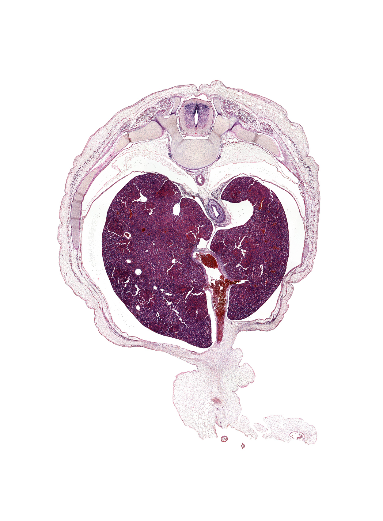 T-9 / T-10 interganglion region, afferent hepatic vein, amnion on surface of umbilical cord, aorta, caudate lobe of liver, dorsal horn of grey matter, ductus venosus, esophagus muscularis, inferior vena cava, junction of ductus venosus and umbilical vein, lateral horn of grey matter, left crus of diaphragm, left lobe of liver, neural arch, pleural recess, rib 10, right lobe of liver, sympathetic trunk, transverse process of T-10 vertebra, ventral horn of grey matter